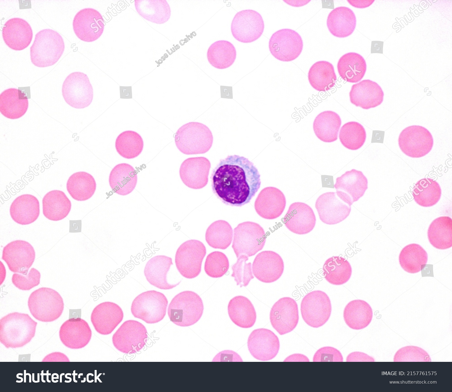 Monocyte Human Blood Smear Stock Photo 2157761575 | Shutterstock