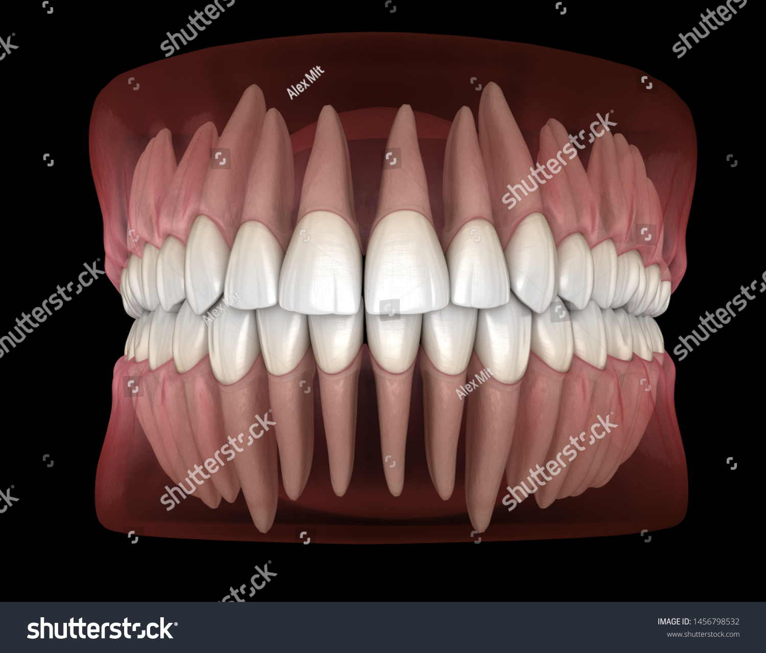 Morphology Mandibular Maxillary Human Gum Teeth Ilustración De Stock 1456798532 Shutterstock 8348