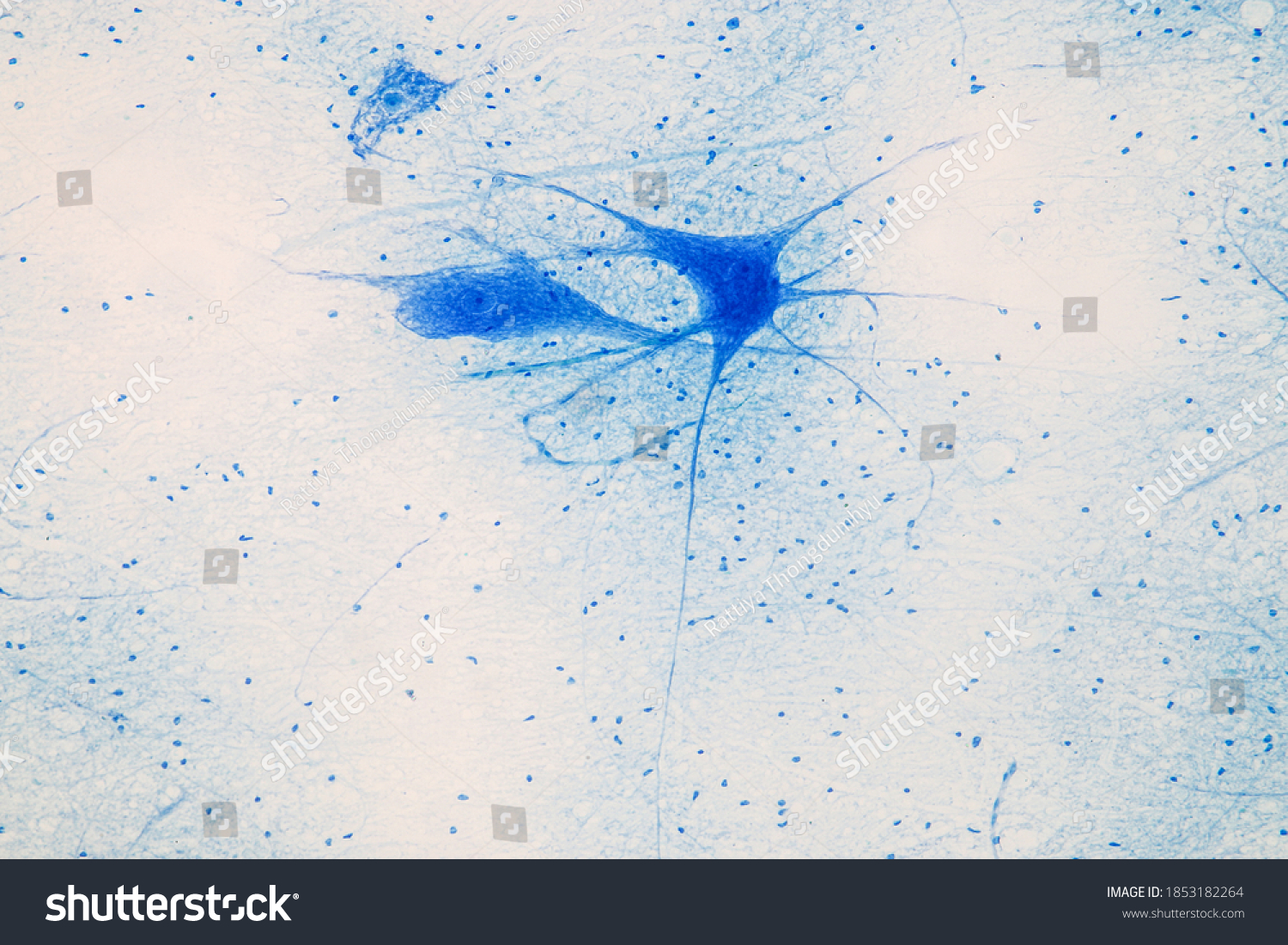 Motor Neuron Under Microscope Lab Stock Photo 1853182264 | Shutterstock