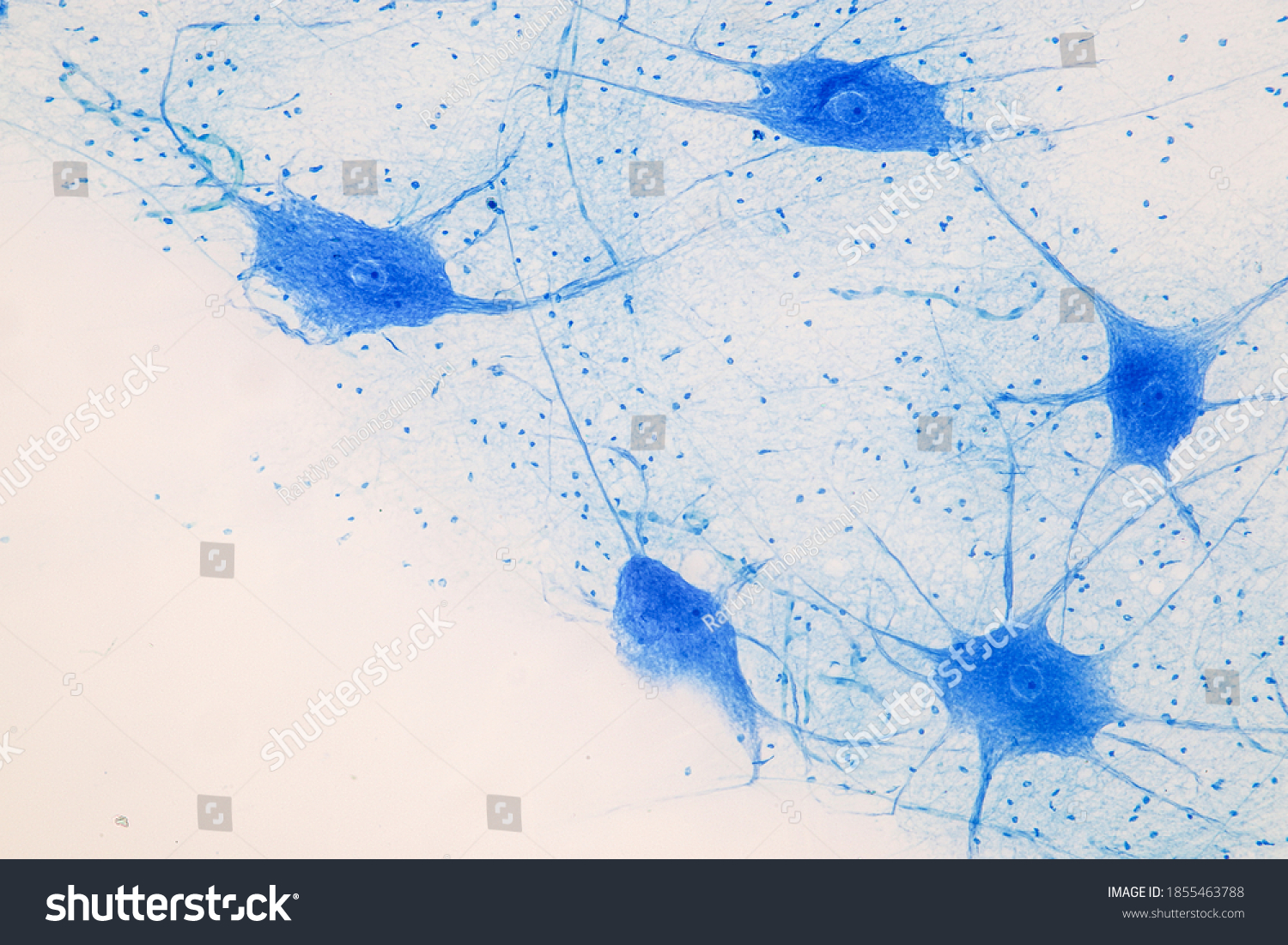 Motor Neuron Under Microscope Lab Foto Stock Editar Agora 1855463788 5466