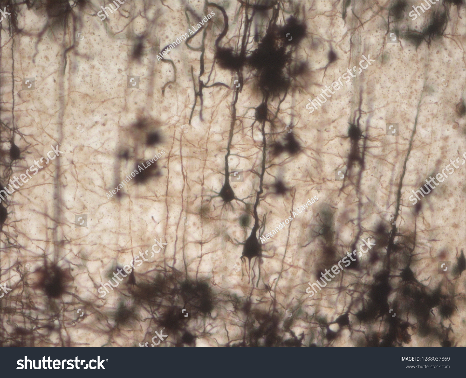 Mouse Brain Section Stained Golgi Stain Stock Photo 1288037869 ...