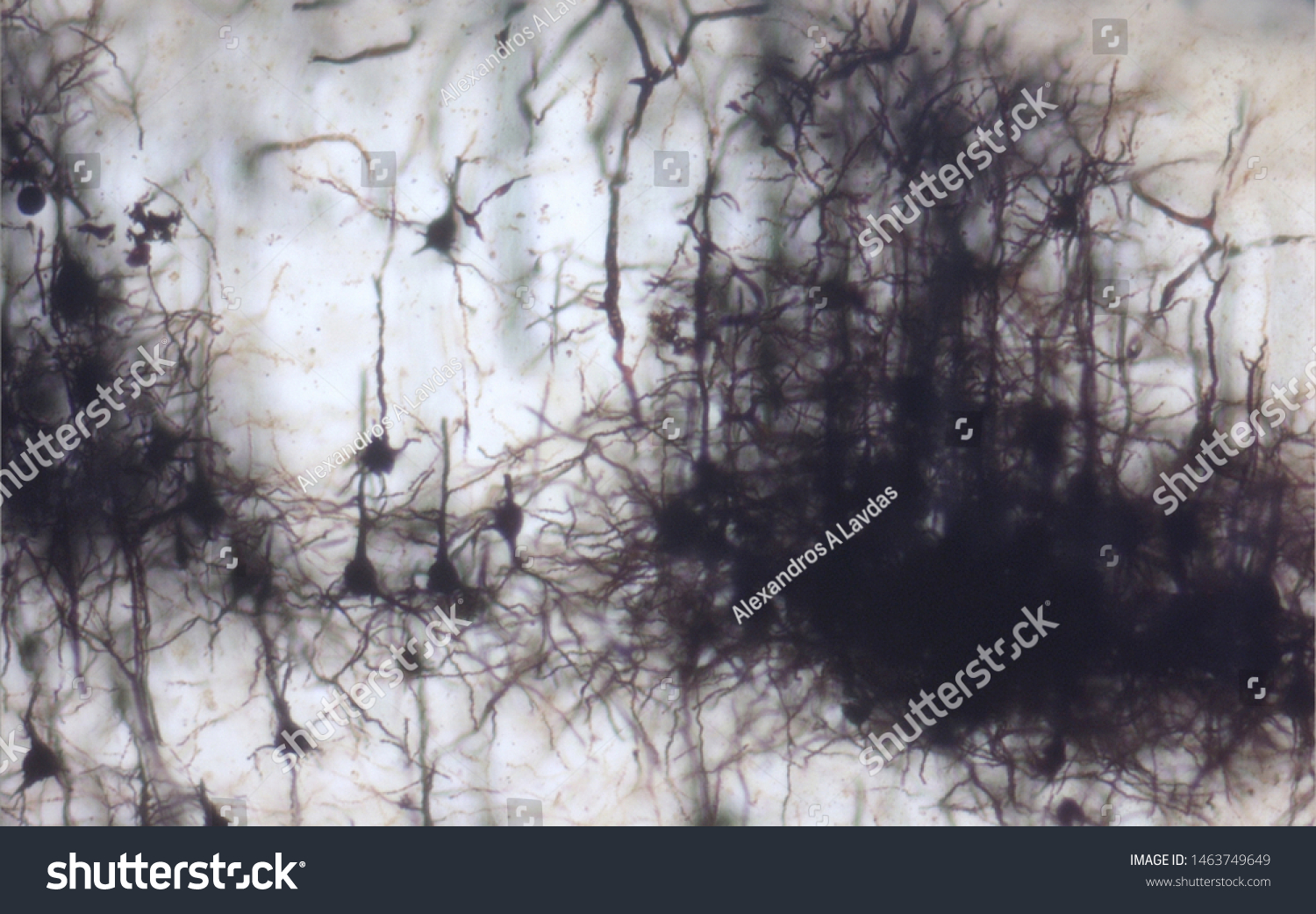 Mouse Brain Section Stained Golgi Stain Stock Photo 1463749649 ...