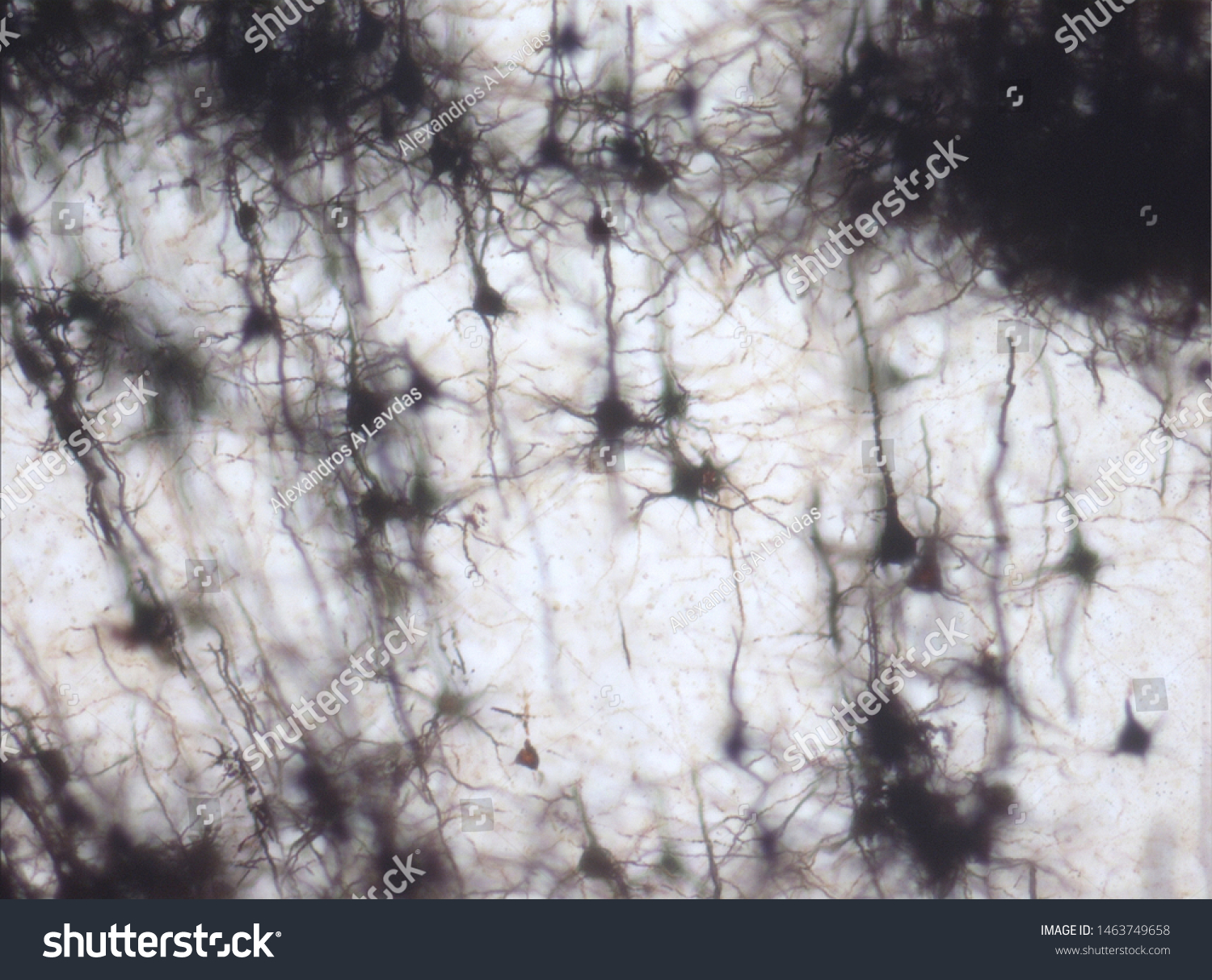 42 Golgi stain Images, Stock Photos & Vectors | Shutterstock