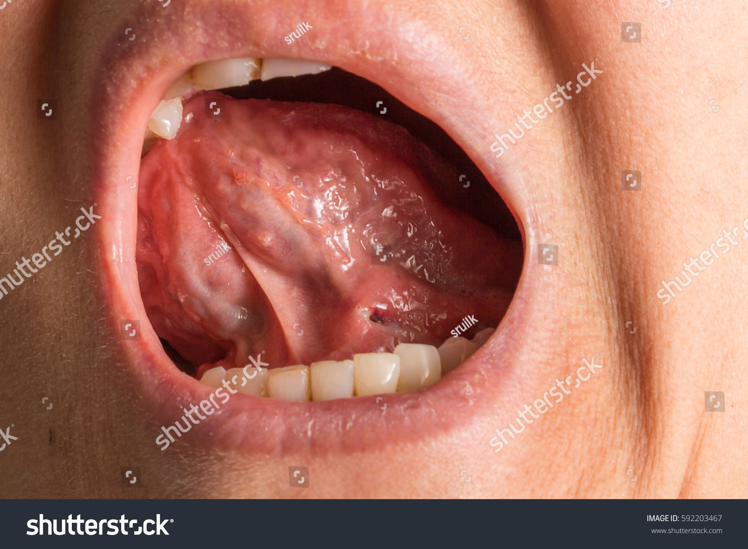 3-259-under-tongue-images-stock-photos-vectors-shutterstock