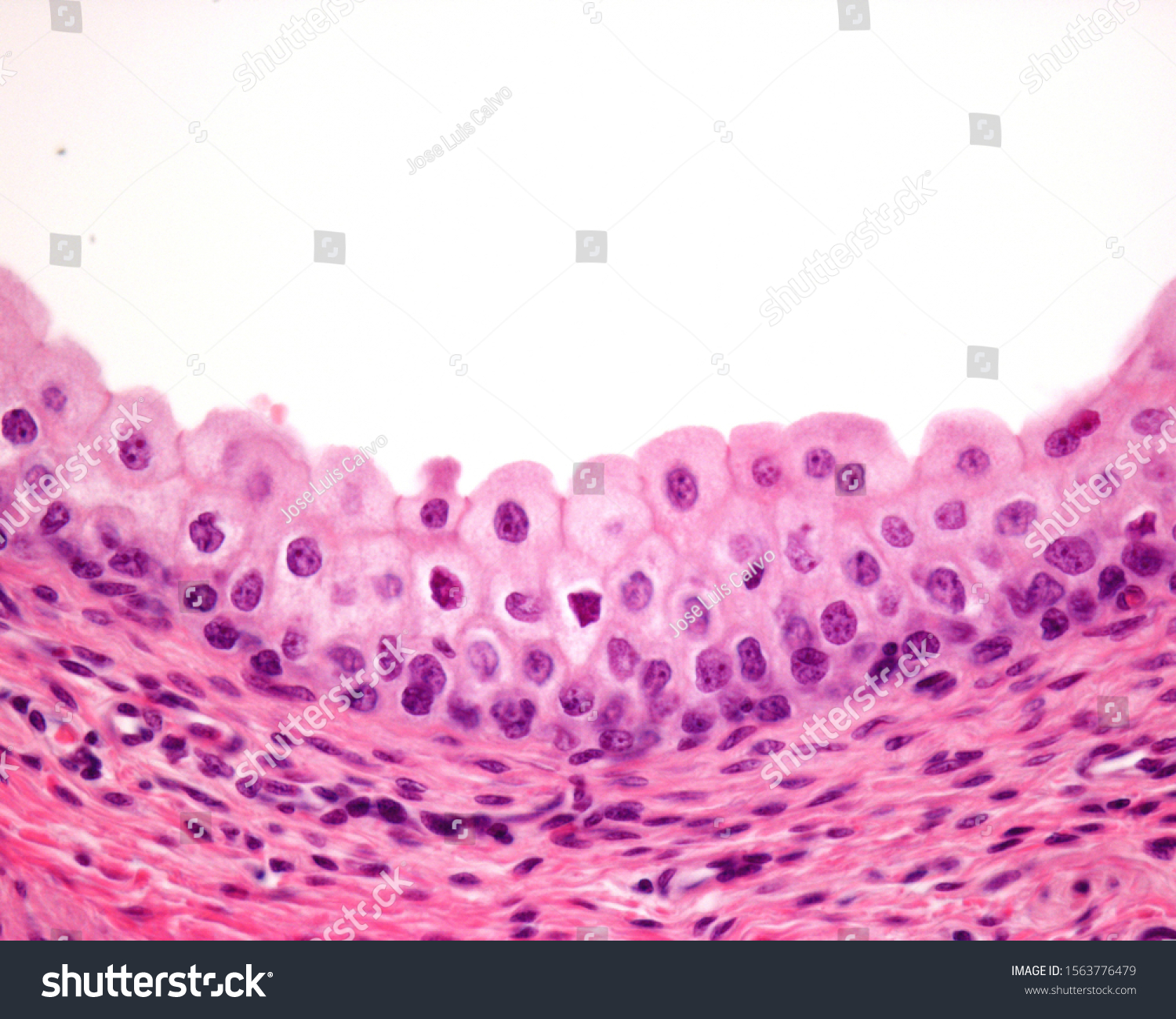 Transitional epithelium Images, Stock Photos & Vectors | Shutterstock