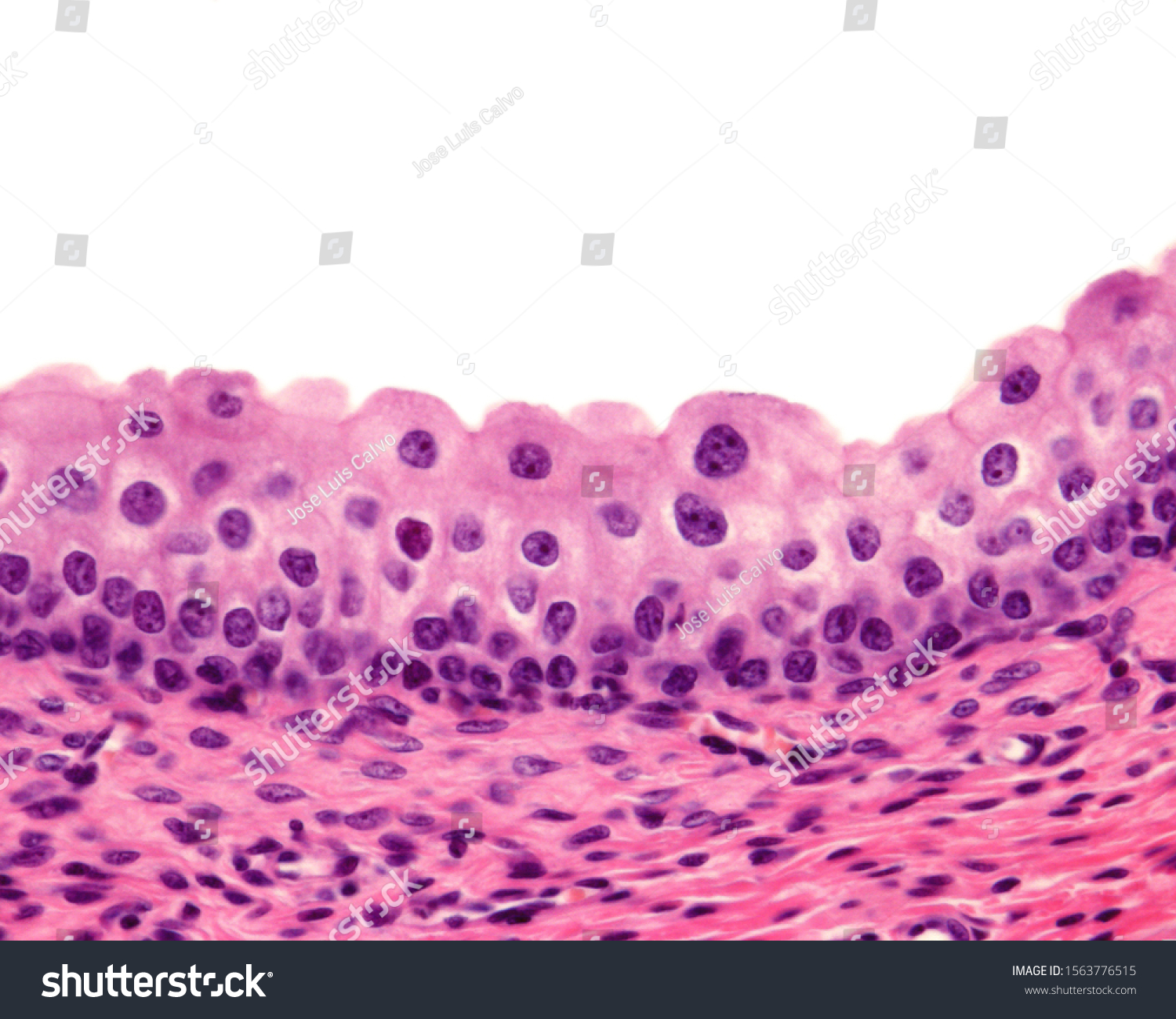 Mucosa Urinary Bladder Transitional Epithelium Urothelium: foto de ...