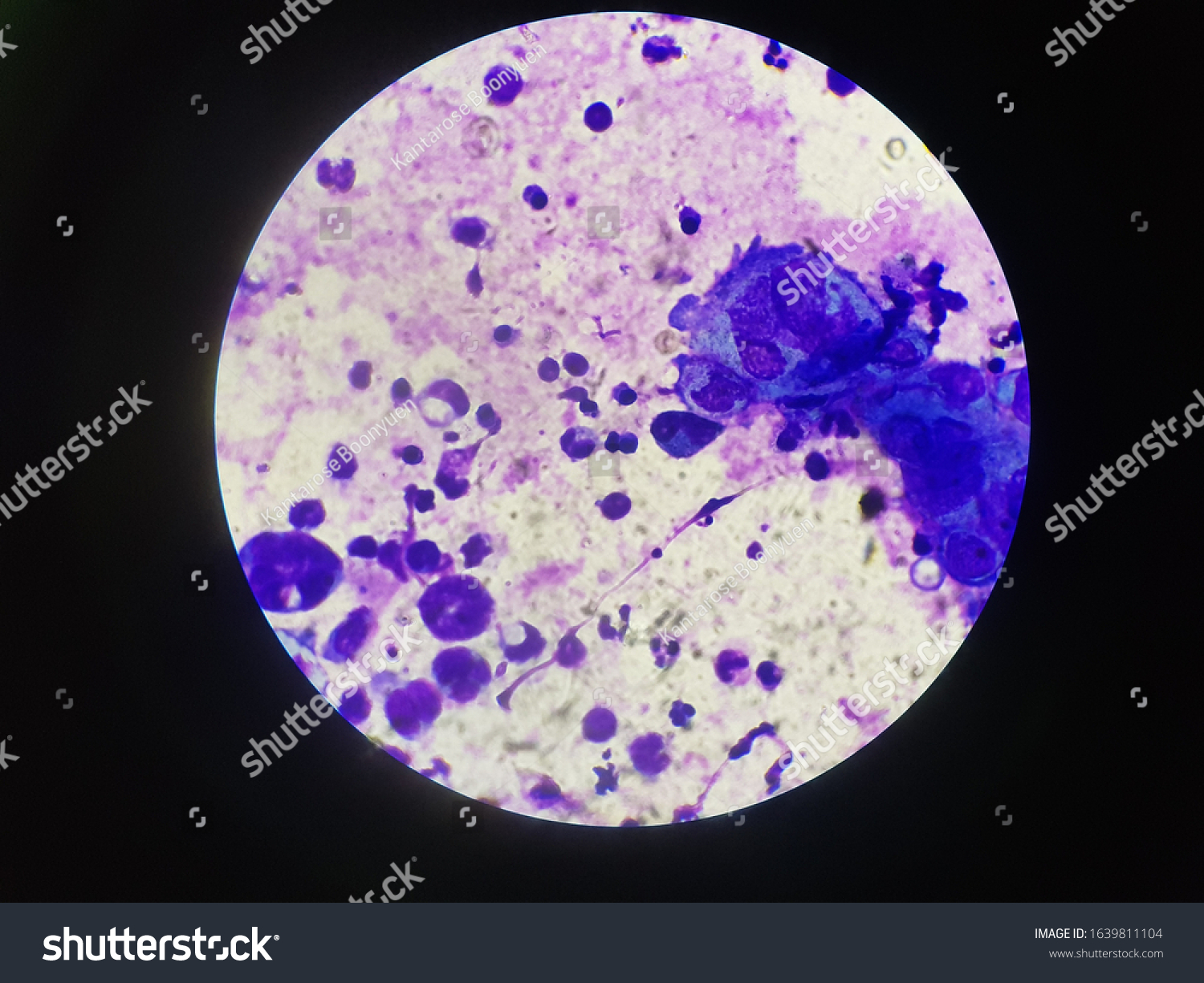 Multinucleated Giant Cells Found Wrights Stain Stock Photo Edit Now 1639811104