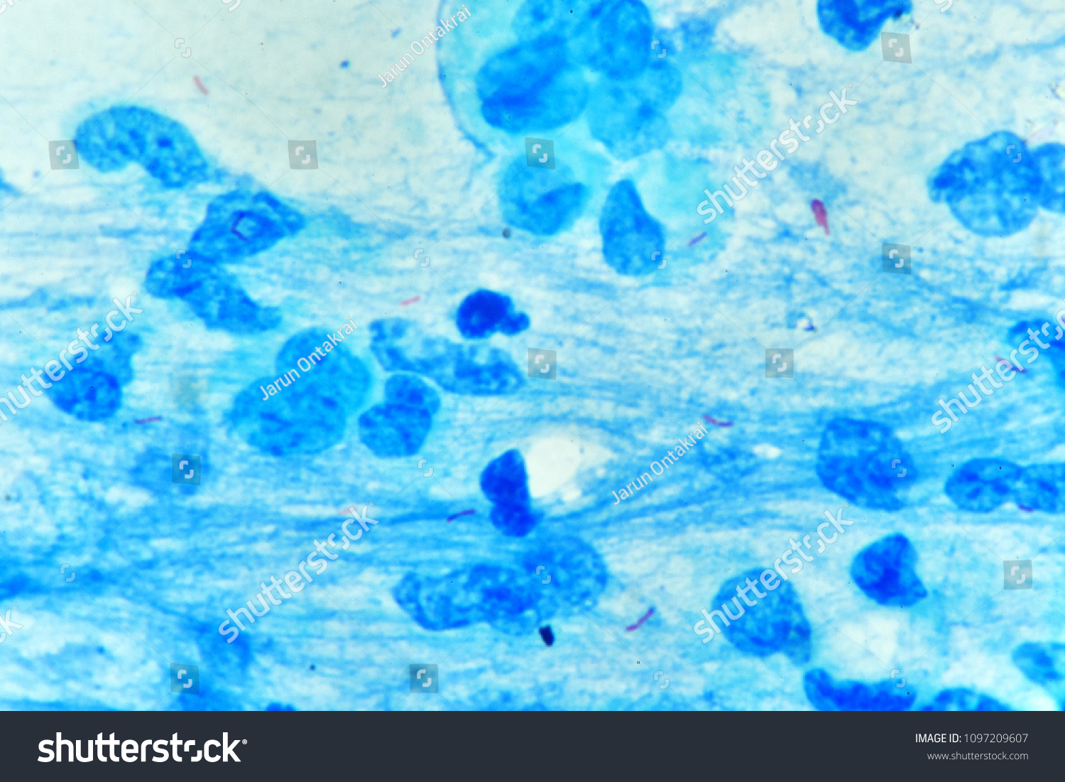 Mycobacterium Positive Small Red Rod Acid Stock Photo 1097209607 ...