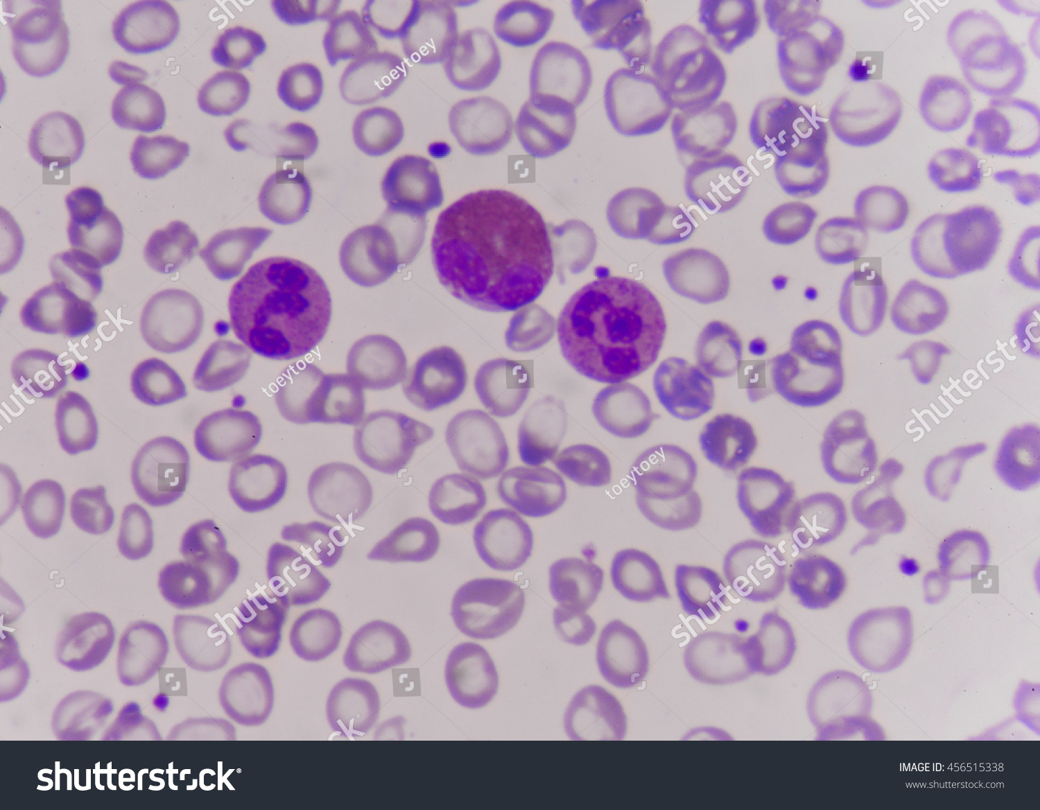 456515338-neutrophil-cell-white-blood-cell