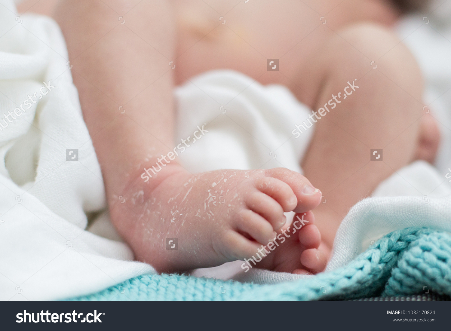 dry baby feet