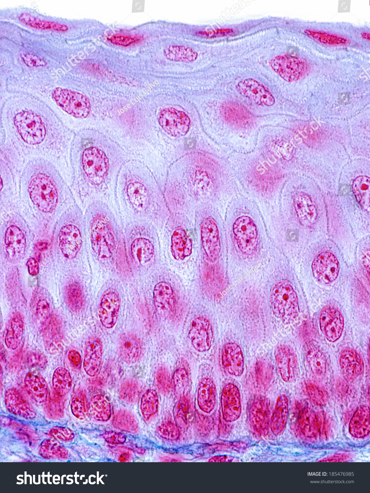 Nonkeratinized Stratified Squamous Or Malpighian Epithelium Stock Photo ...