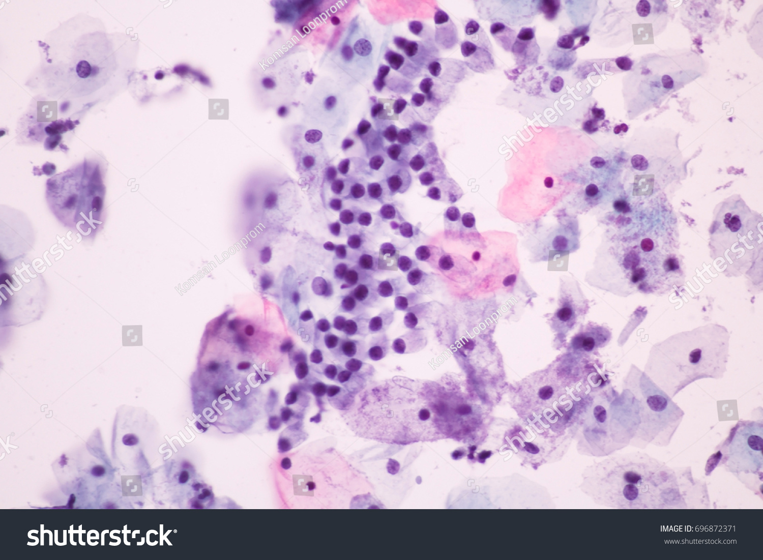 normal-endocervical-cells-squamous-epithelial-cells-foto-stok-696872371