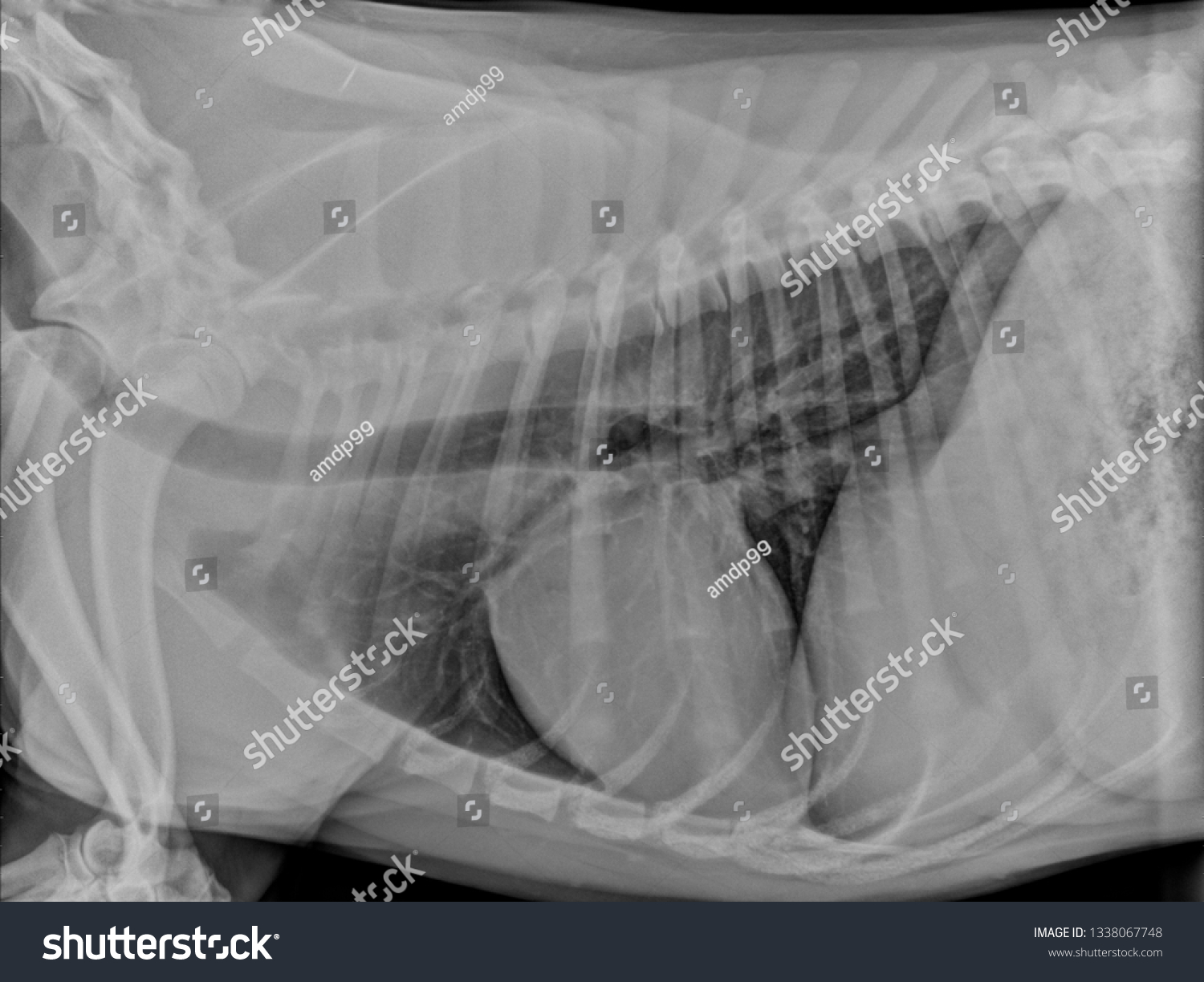 Normal Lateral Thoracic Chest Xray Radiograph ภาพประกอบสตอก 1338067748 Shutterstock