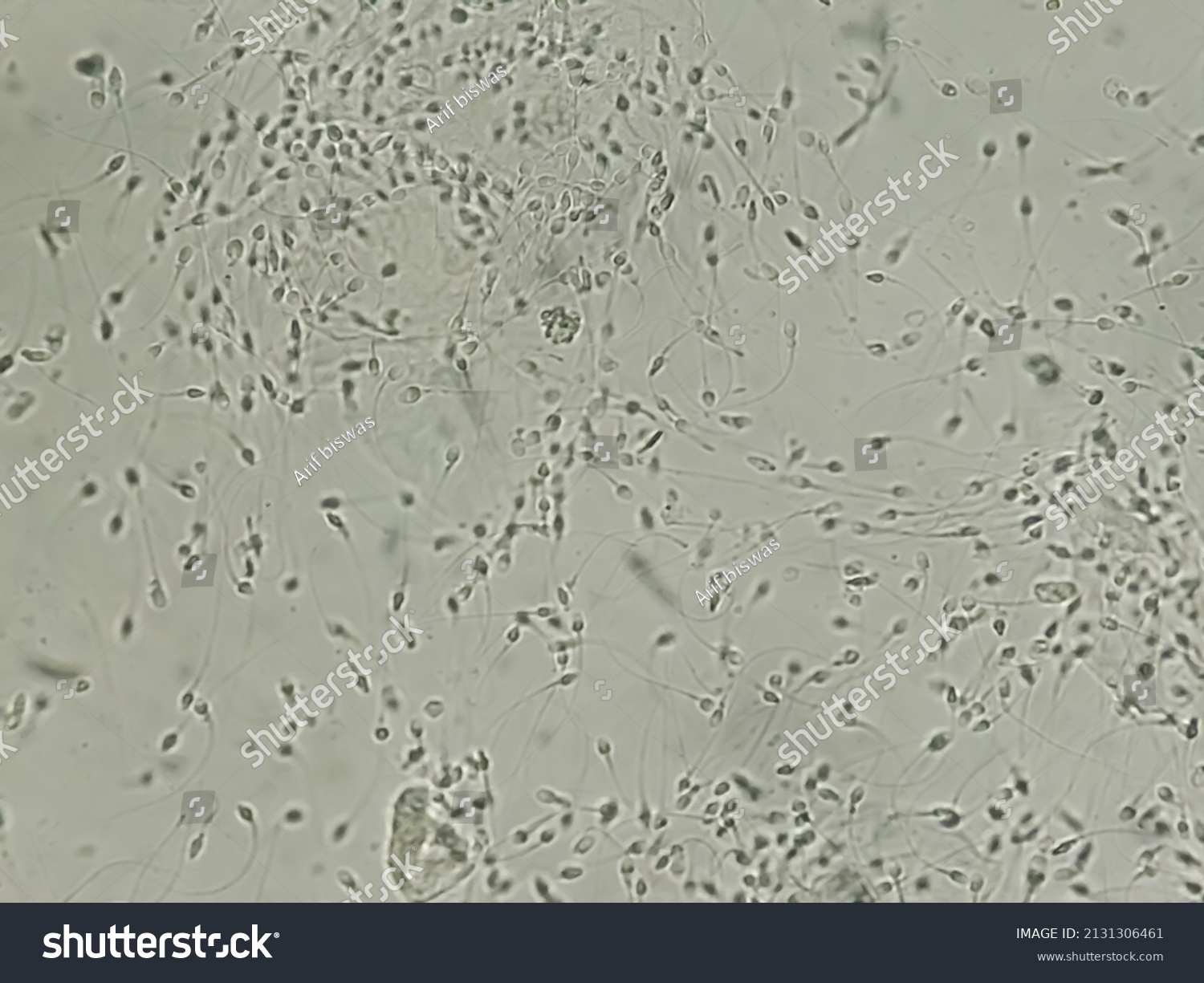 36 Teratozoospermia Images, Stock Photos & Vectors | Shutterstock