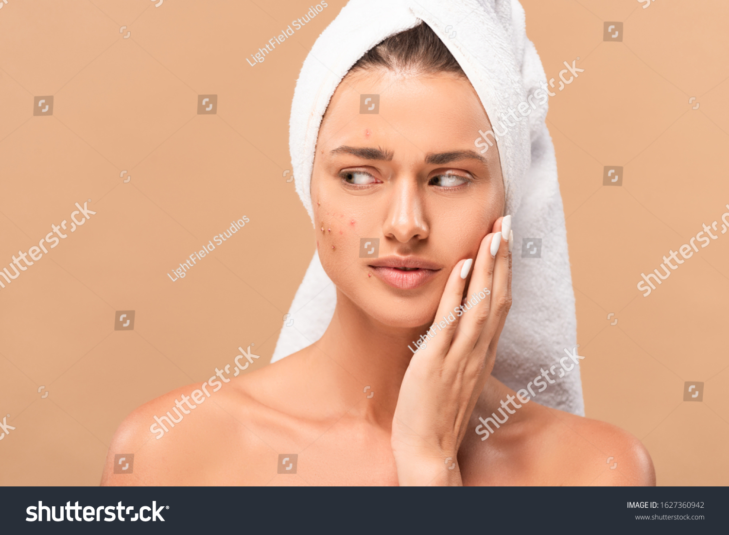 Nude Girl Towel Touching Face Acne Foto Stok Shutterstock