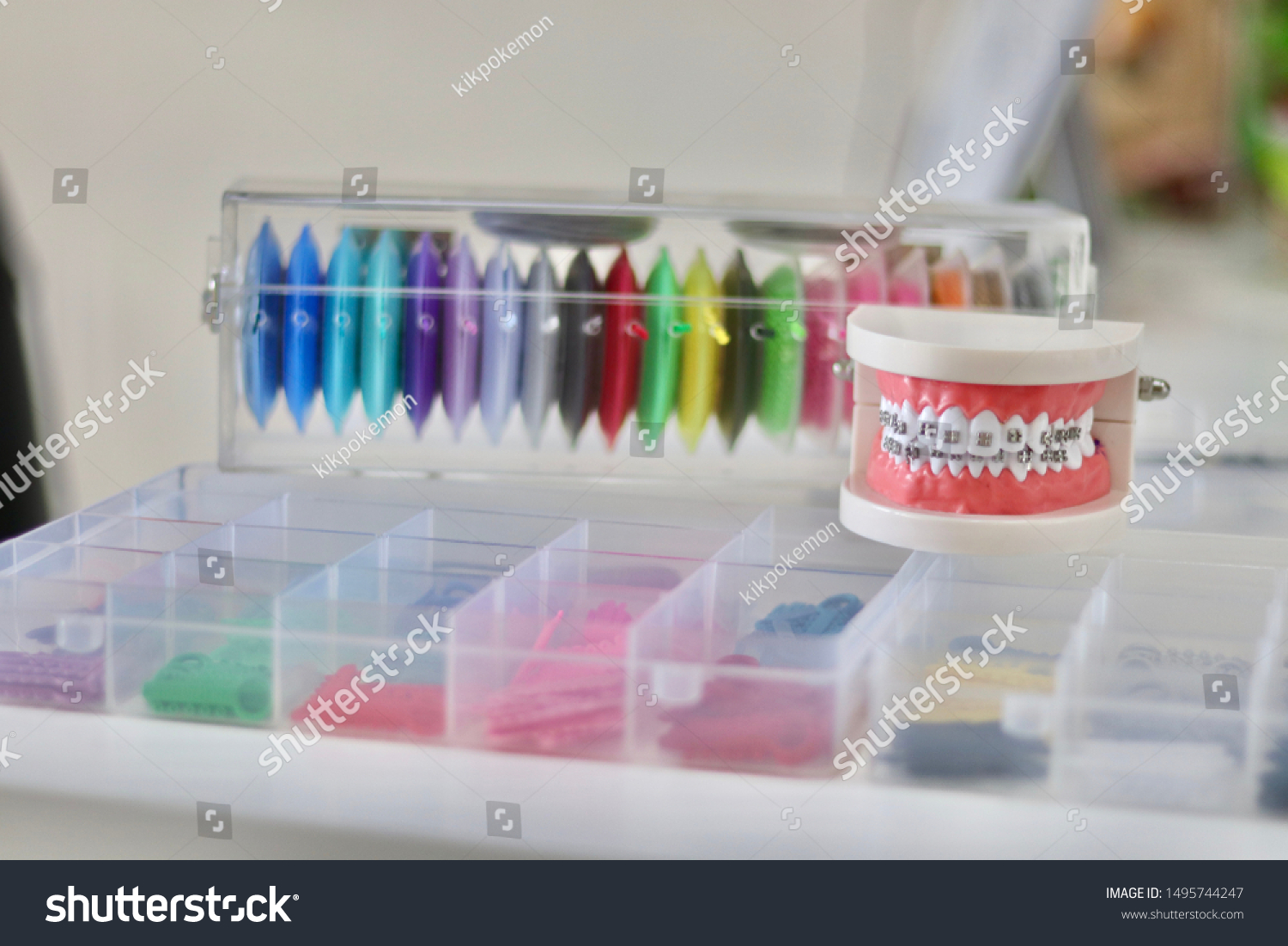 Oring Dental Orthodontics Elastomeric Rings Colourful Stock Photo Edit Now