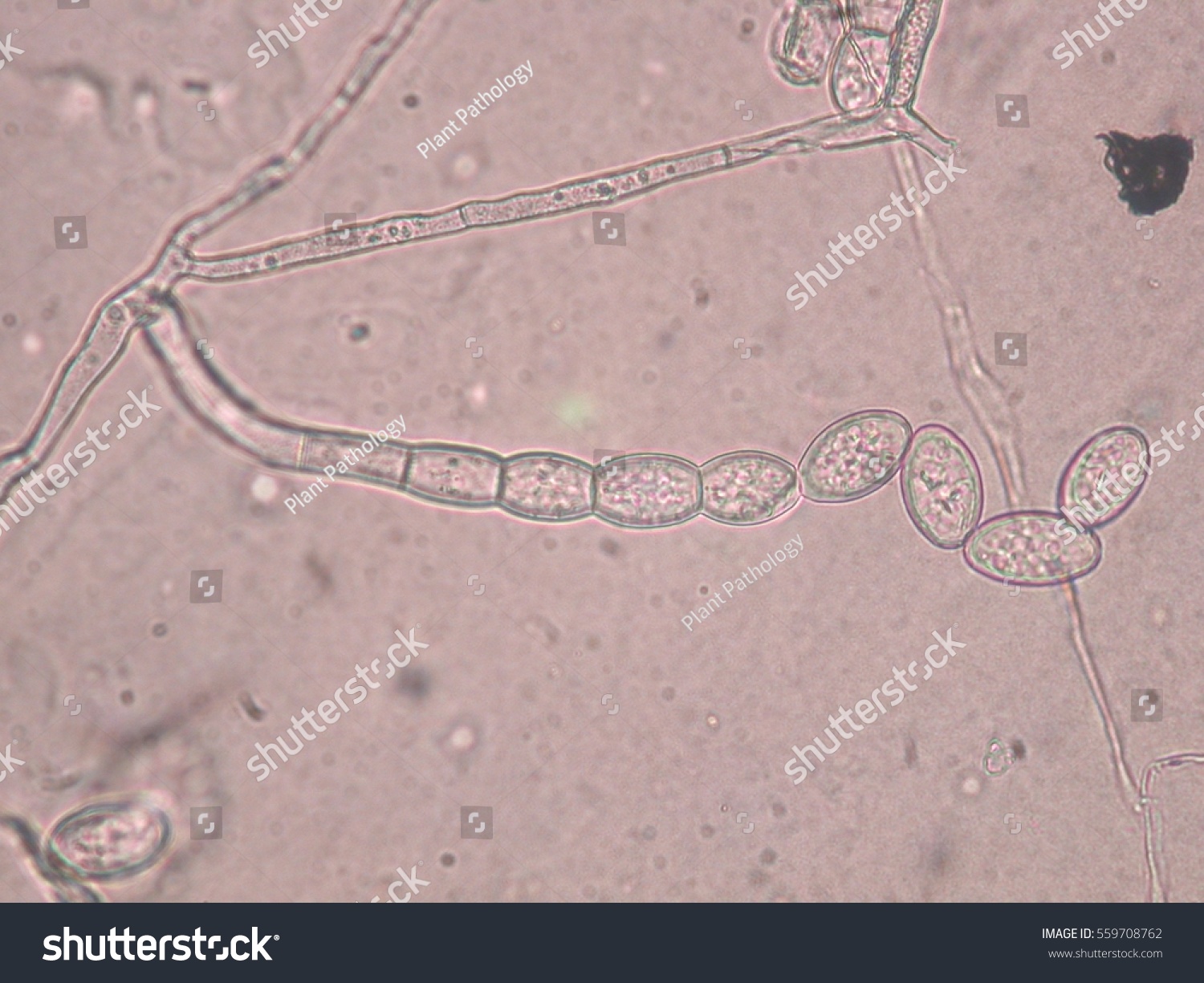 Oidium Spores Stock Photo 559708762 - Shutterstock