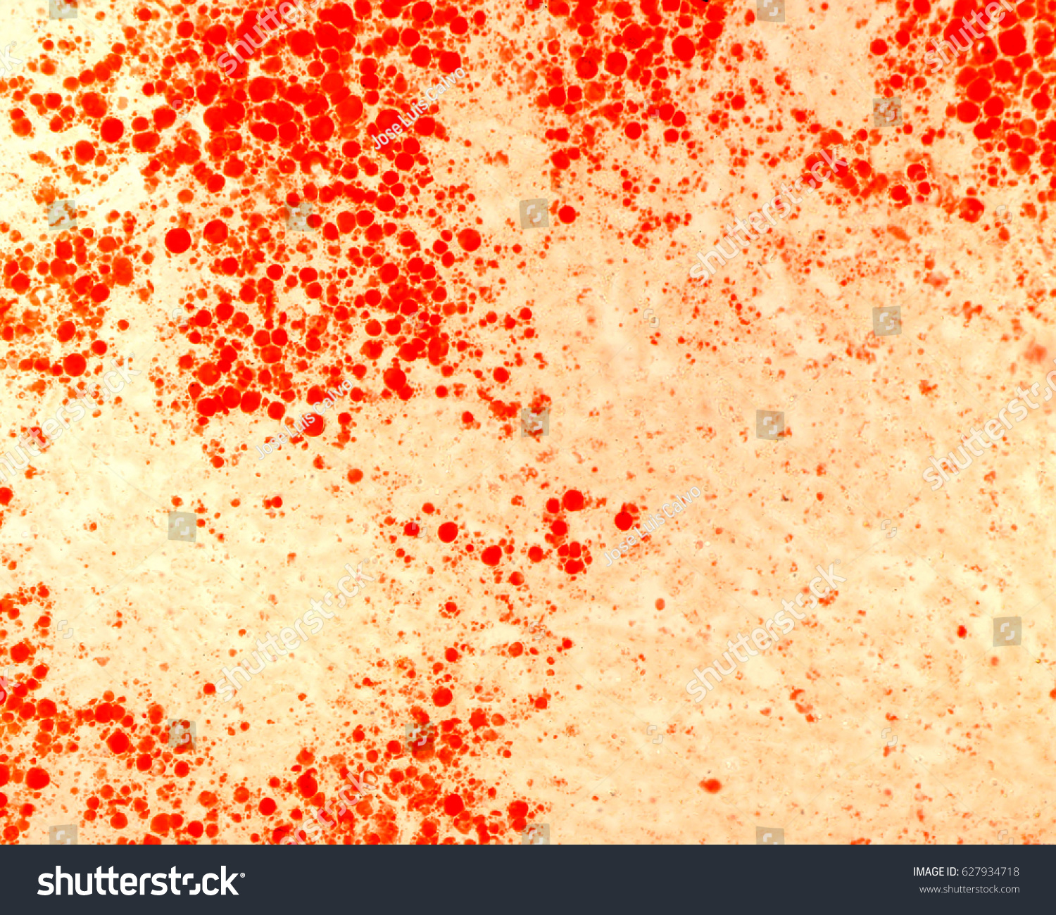 Oilred O Staining Red Color Shows Stock Photo Edit Now