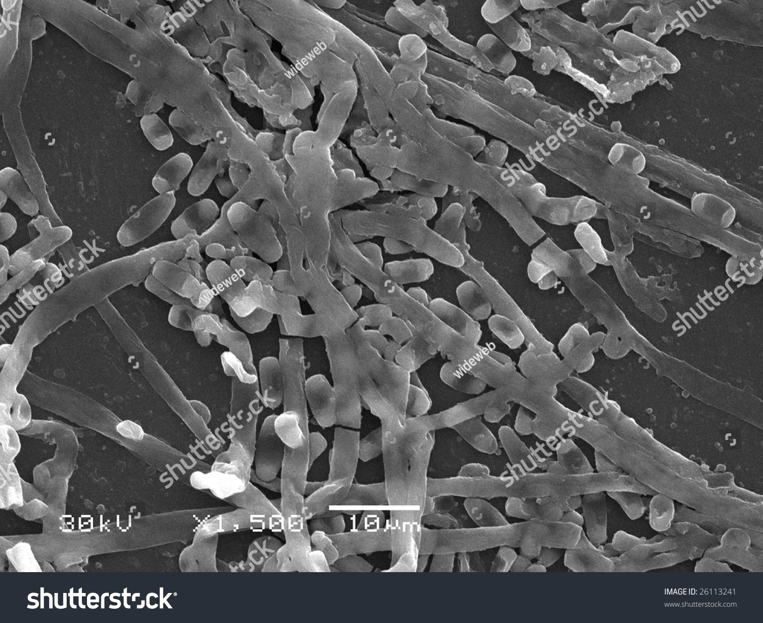 Original Scanning Electron Microscope Images Fungi Stock Photo Shutterstock