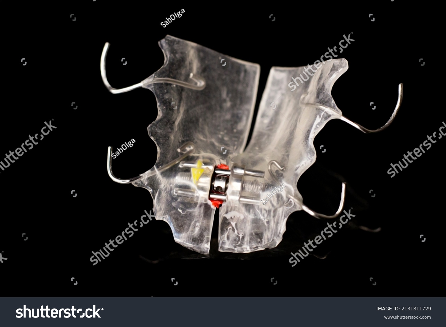 Orthodontic Plate Bite Correction Stock Photo Edit Now 2131811729