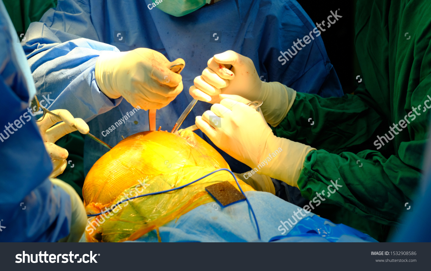 Orthopedic Surgeon Performing Total Knee Replacement Stock Photo ...