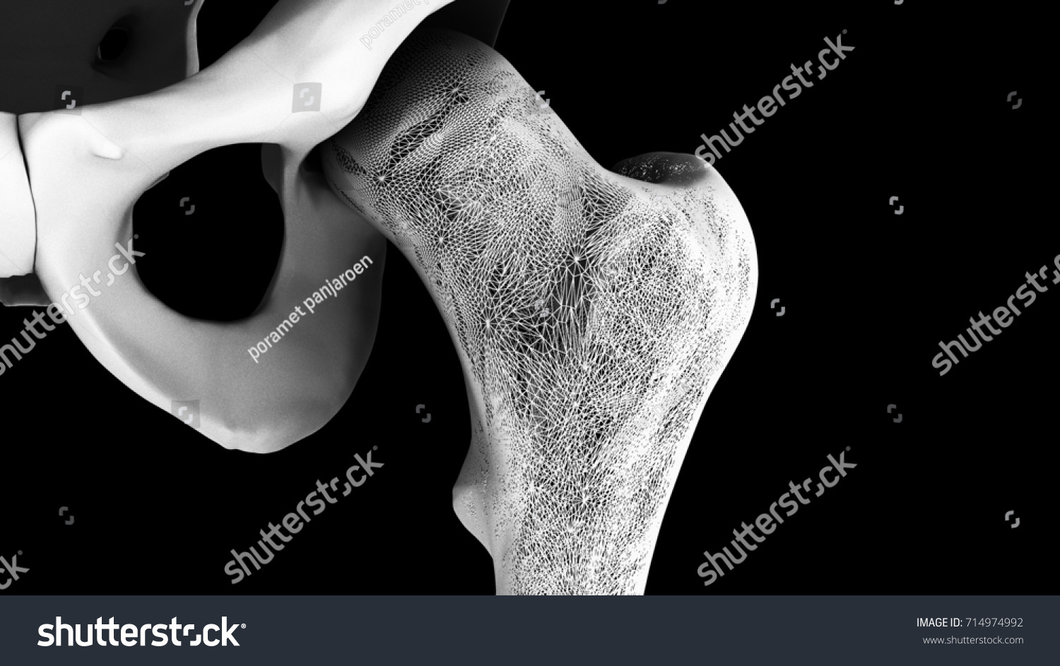 Osteoporosis Bones Human 3d Rendering Black Stock Illustration ...