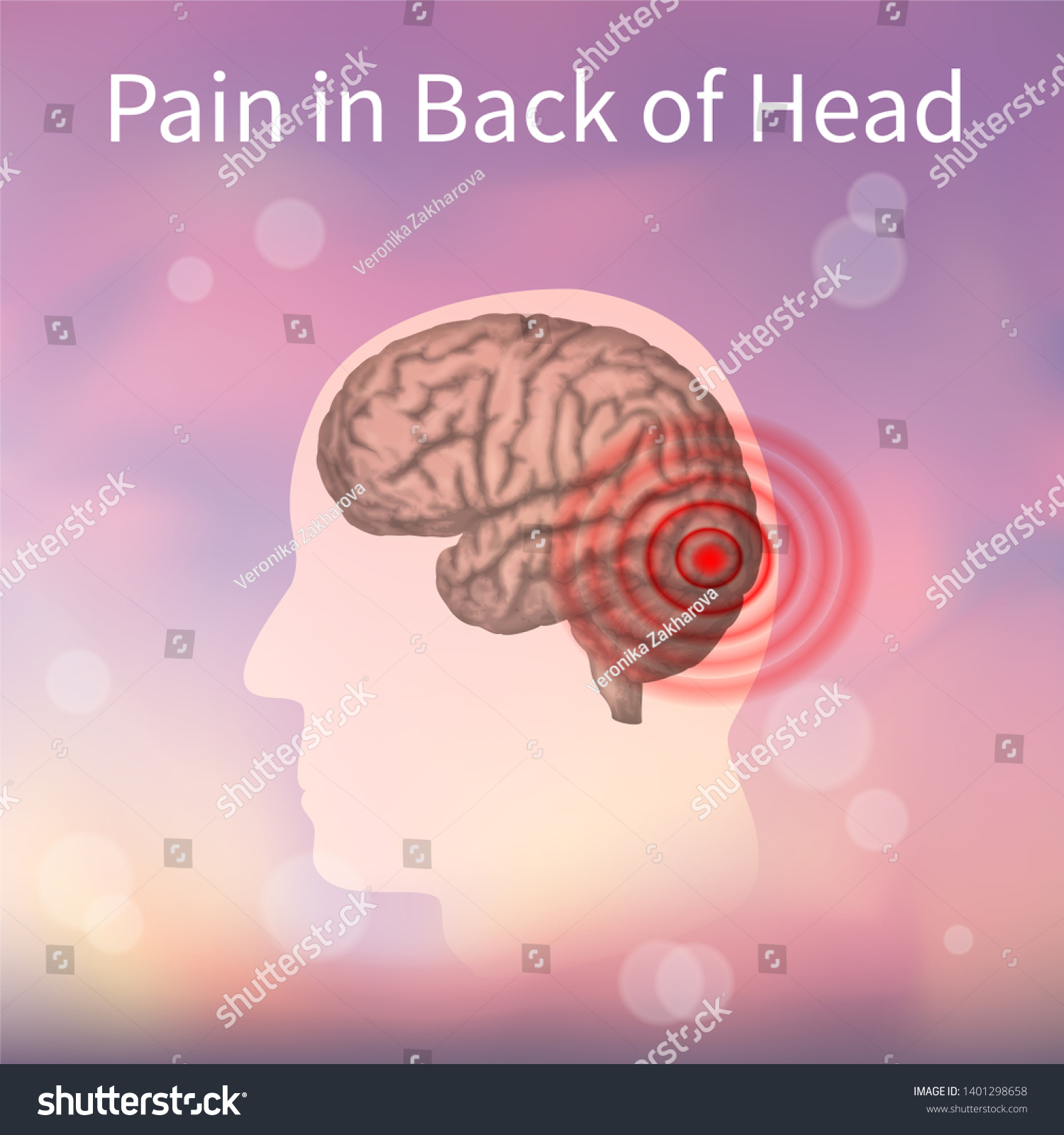 Pain Back Head Realistic Anatomy Illustration Stock Illustration