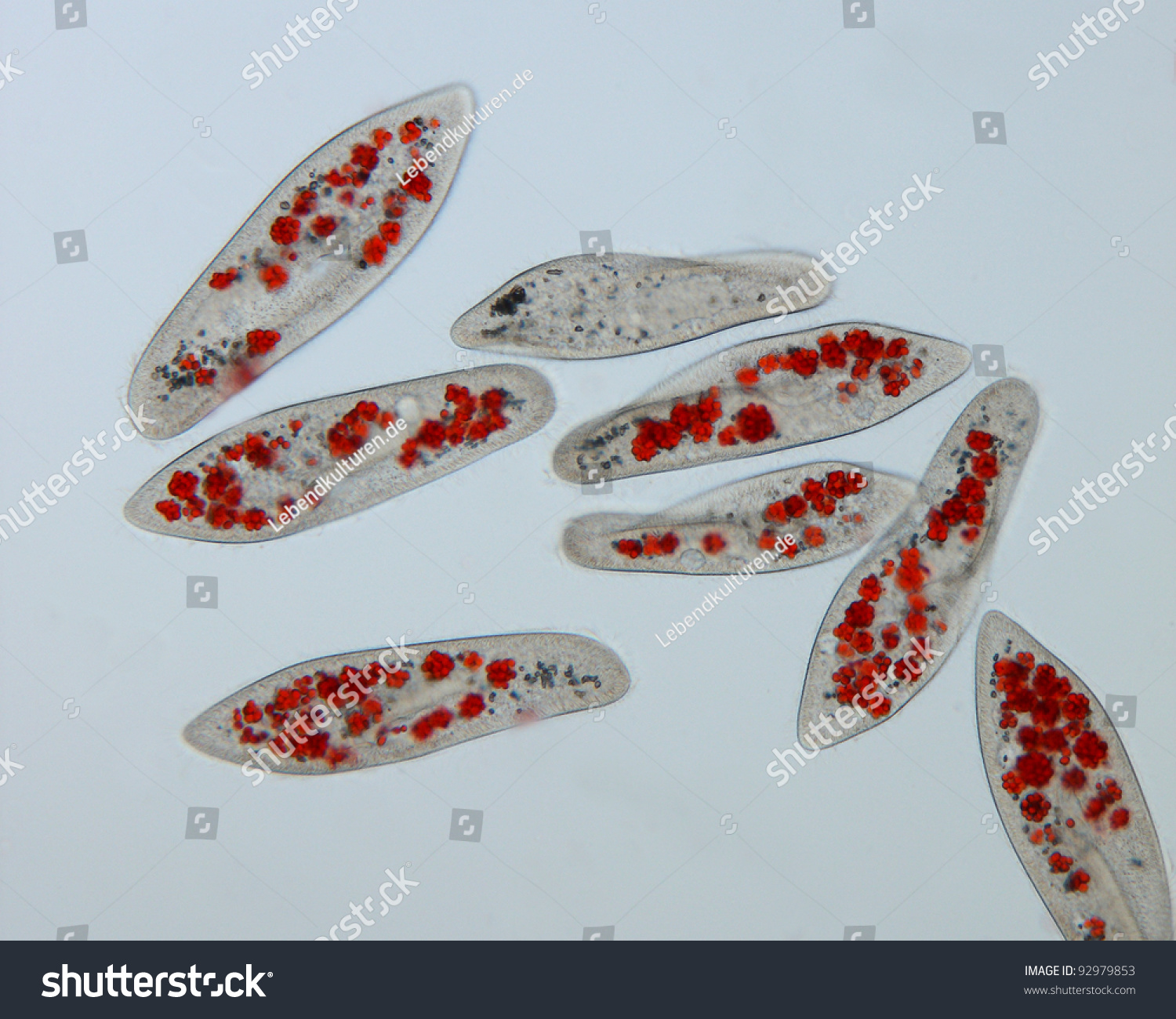 Paramecium Caudatum Feeded With Coloured Yeast Cells Brightfield Focus ...