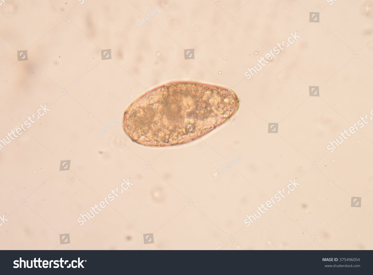 Parasite Stool Exam Fine Microscope Laboratory Stock Photo 375496054 ...