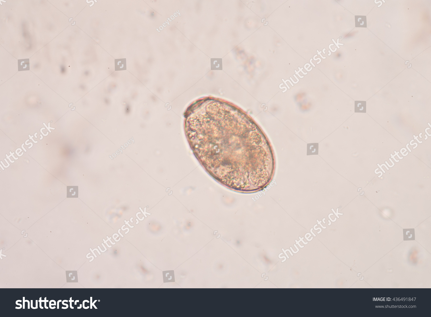 Parasitic Egg Under Microscope Stock Photo (edit Now) 436491847