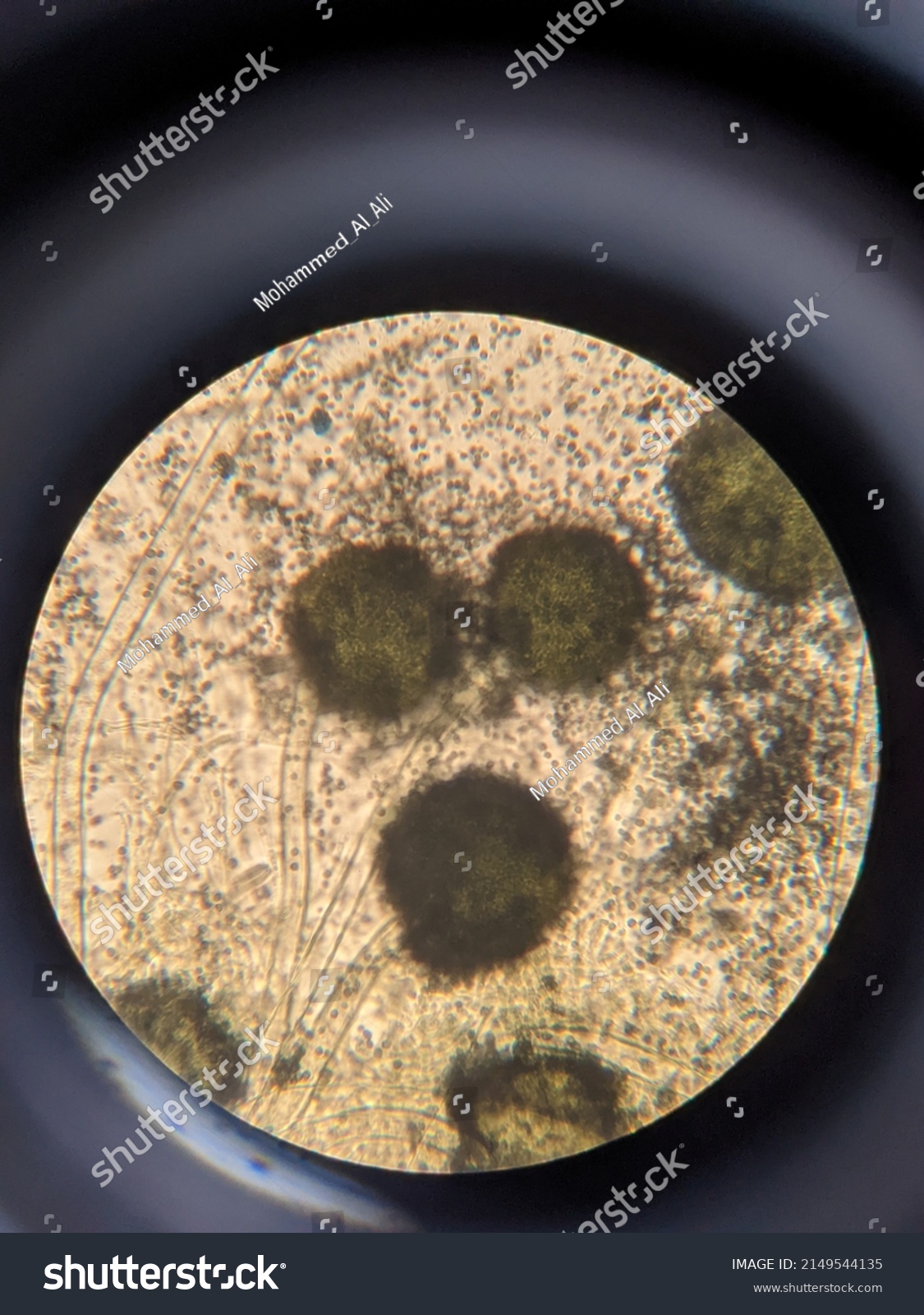 Photo Under Microscope Fungi Growth On Stock Photo 2149544135 ...