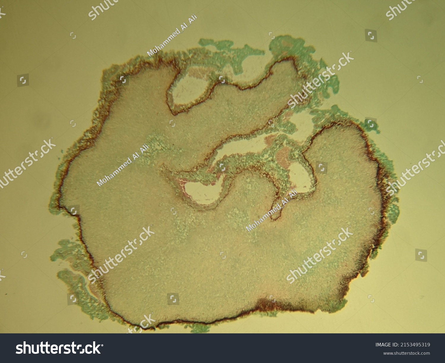 Photo Under Microscope Fungi Growth On Stock Photo 2153495319 ...