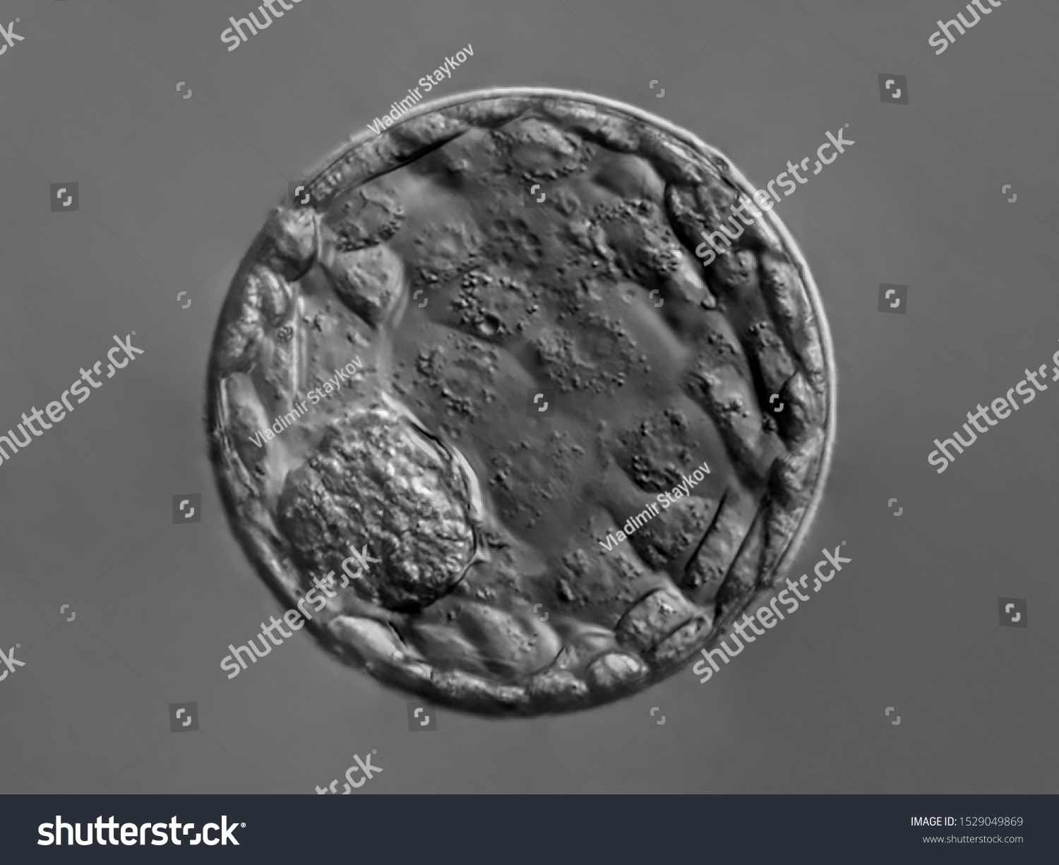 1,568 Blastocyst Images, Stock Photos & Vectors | Shutterstock