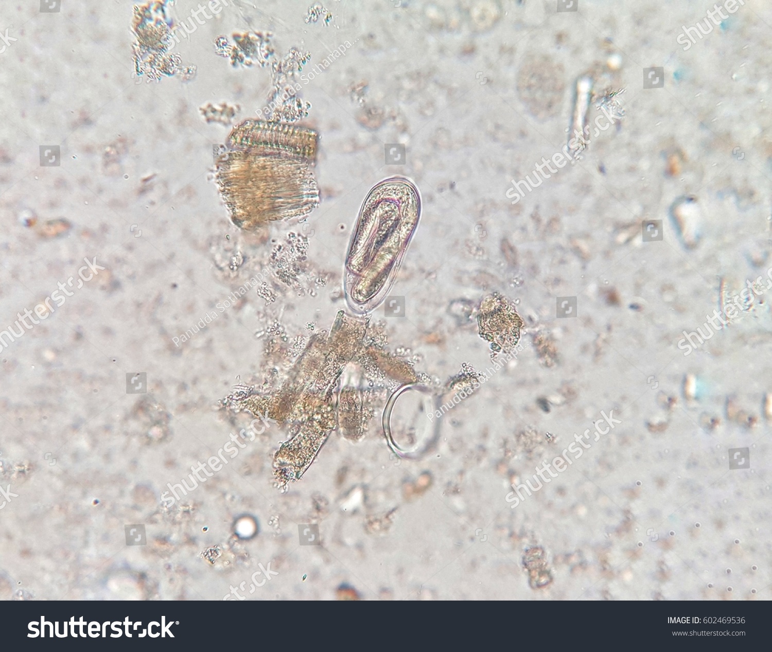 enterobius vermicularis in stool viermi la copii de ce vin viermii
