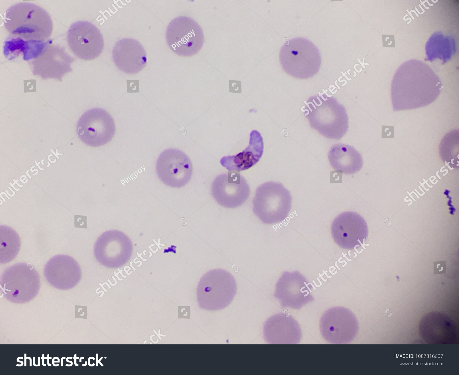 Plasmodium Falciparum Gametocyte Blood Smear Stok Foto Raf