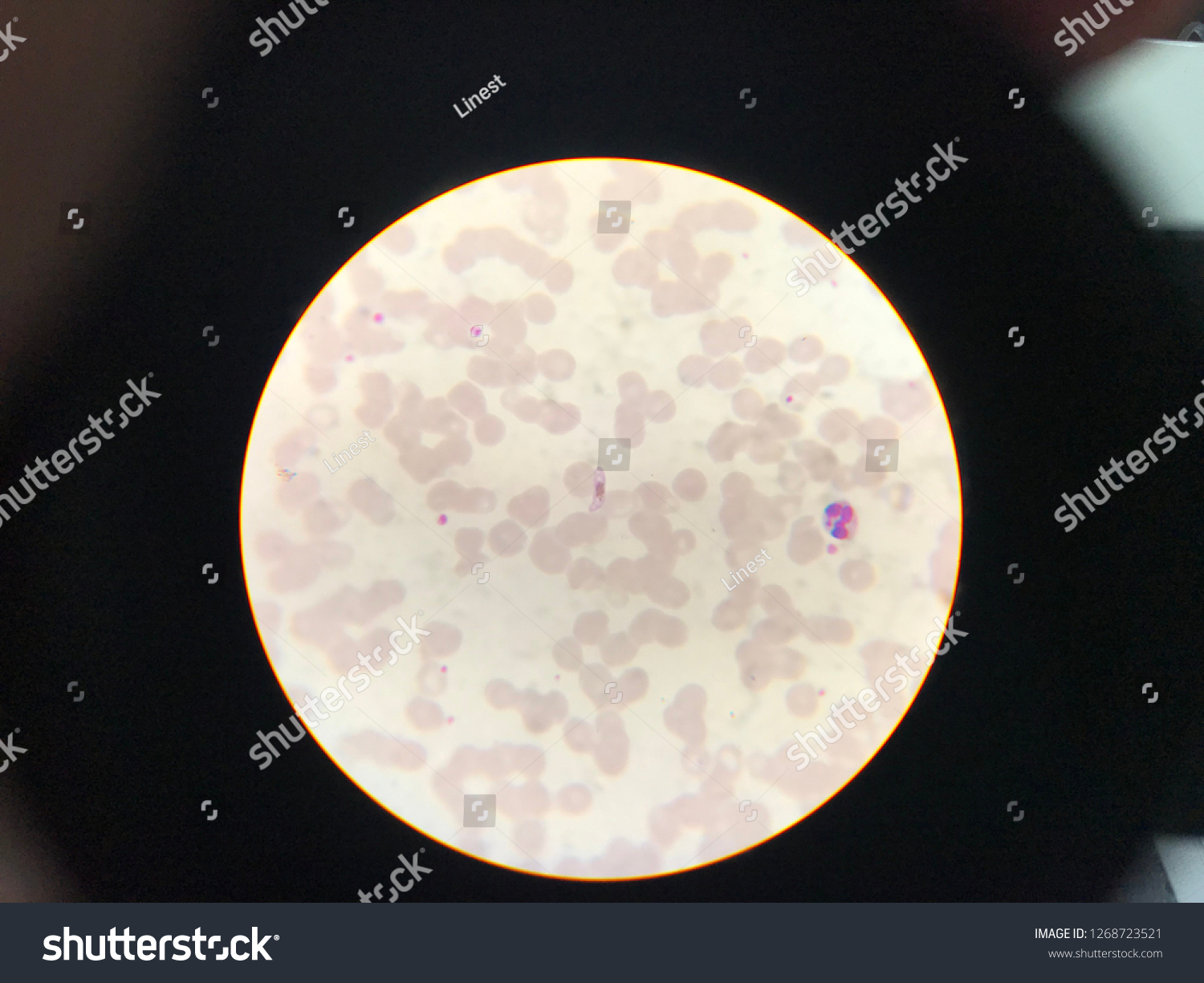 Plasmodium Falciparum Gametocyte Stage Light Microscope Stock Photo ...