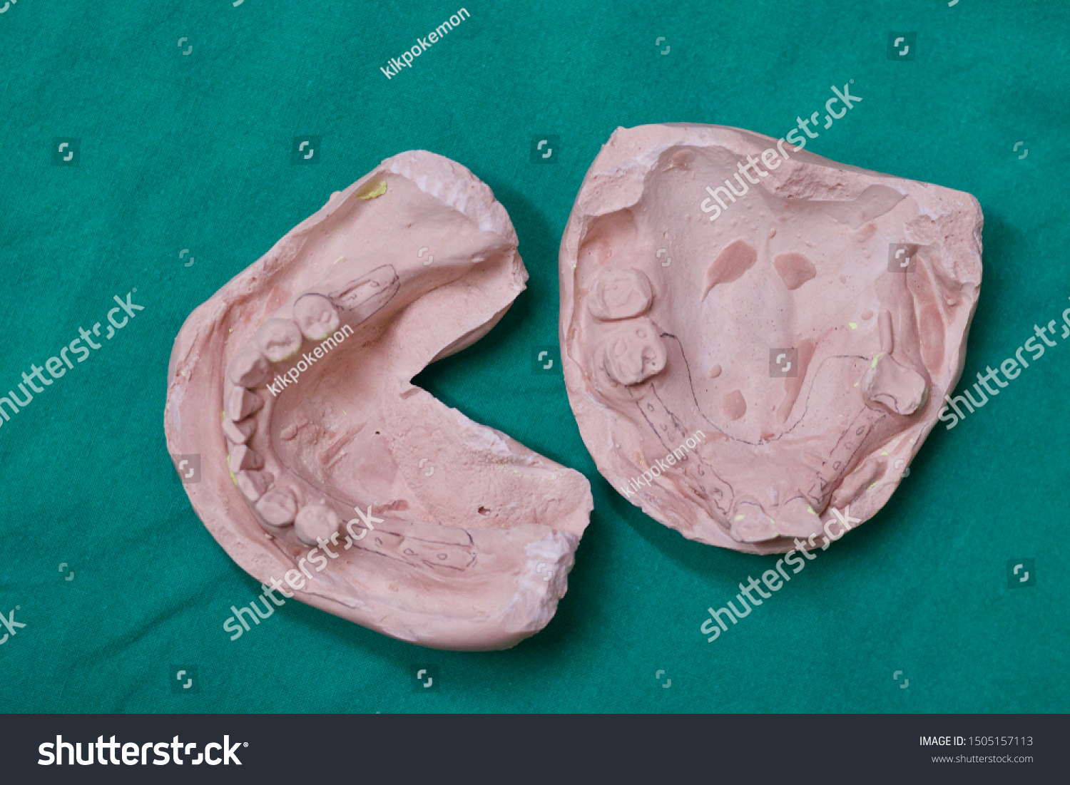 5,801 Dental plaster model Images, Stock Photos & Vectors Shutterstock