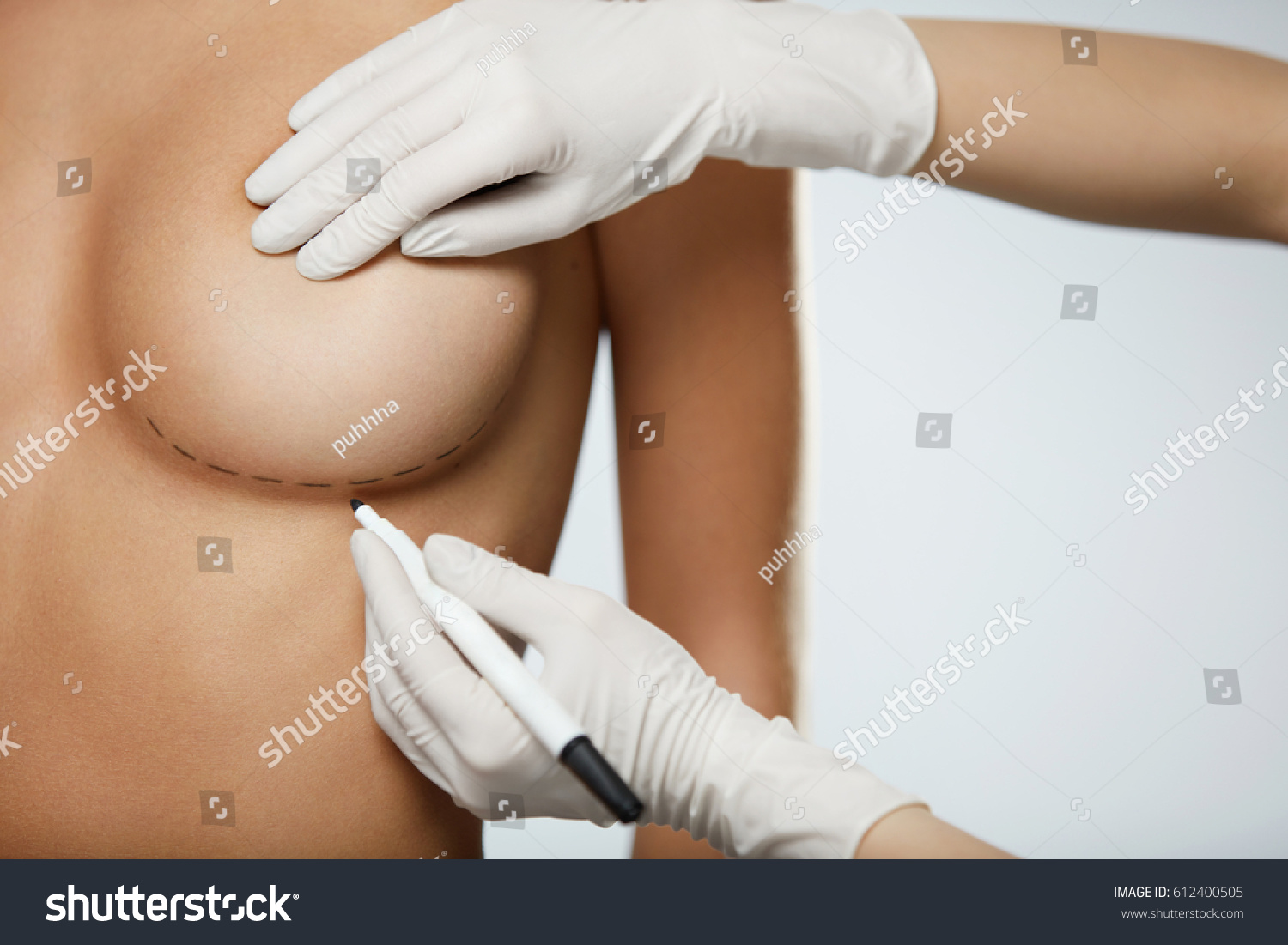 Plastic Surgery Closeup Naked Sexy Woman Stock Photo Edit Now