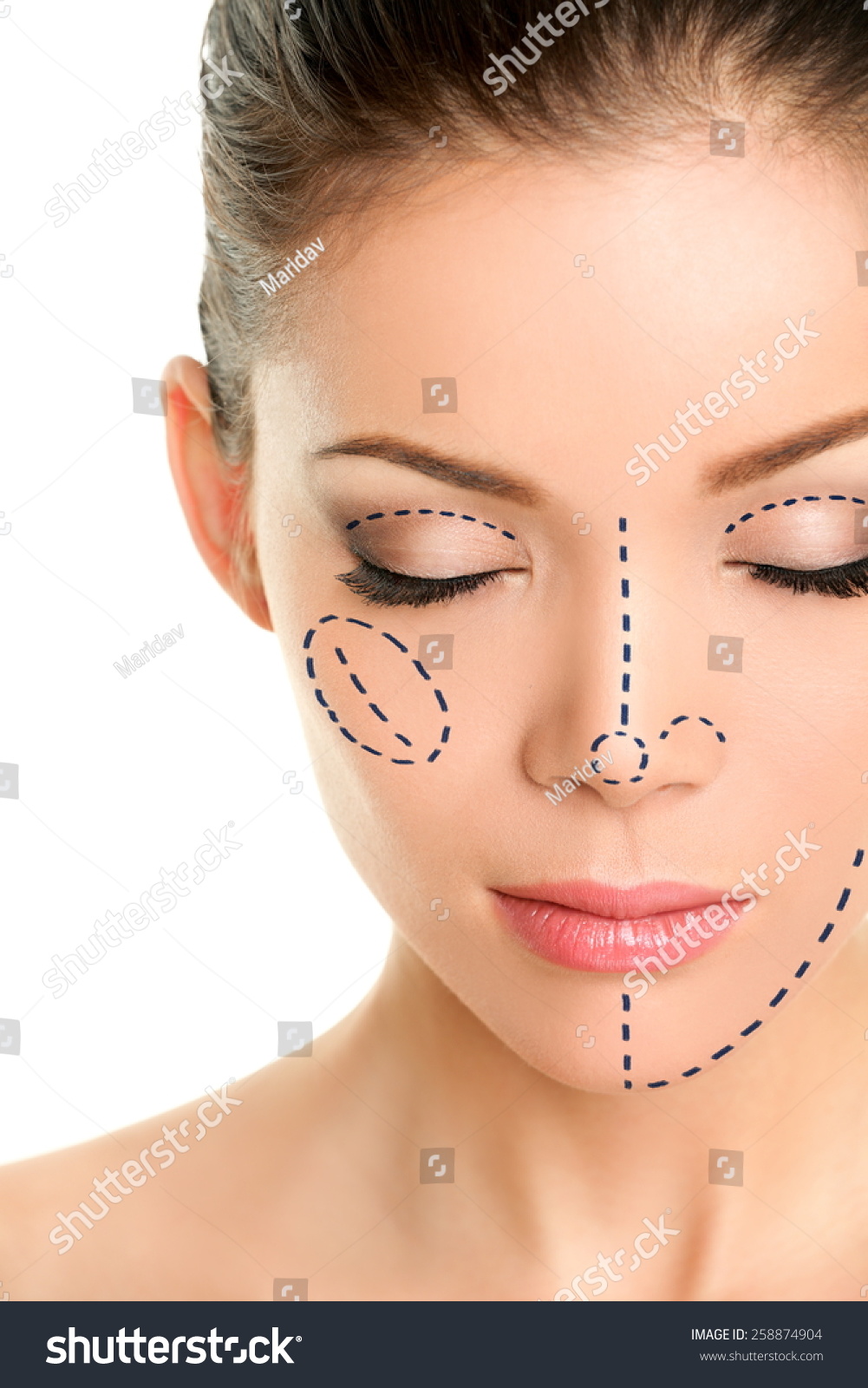 Cosmetic Surgery Of The Asian Face 14