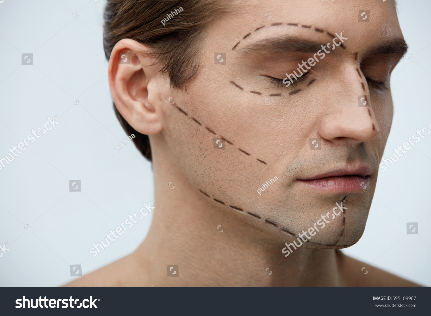 Plastic Surgery Portrait Handsome Young Man Stock Photo Edit Now