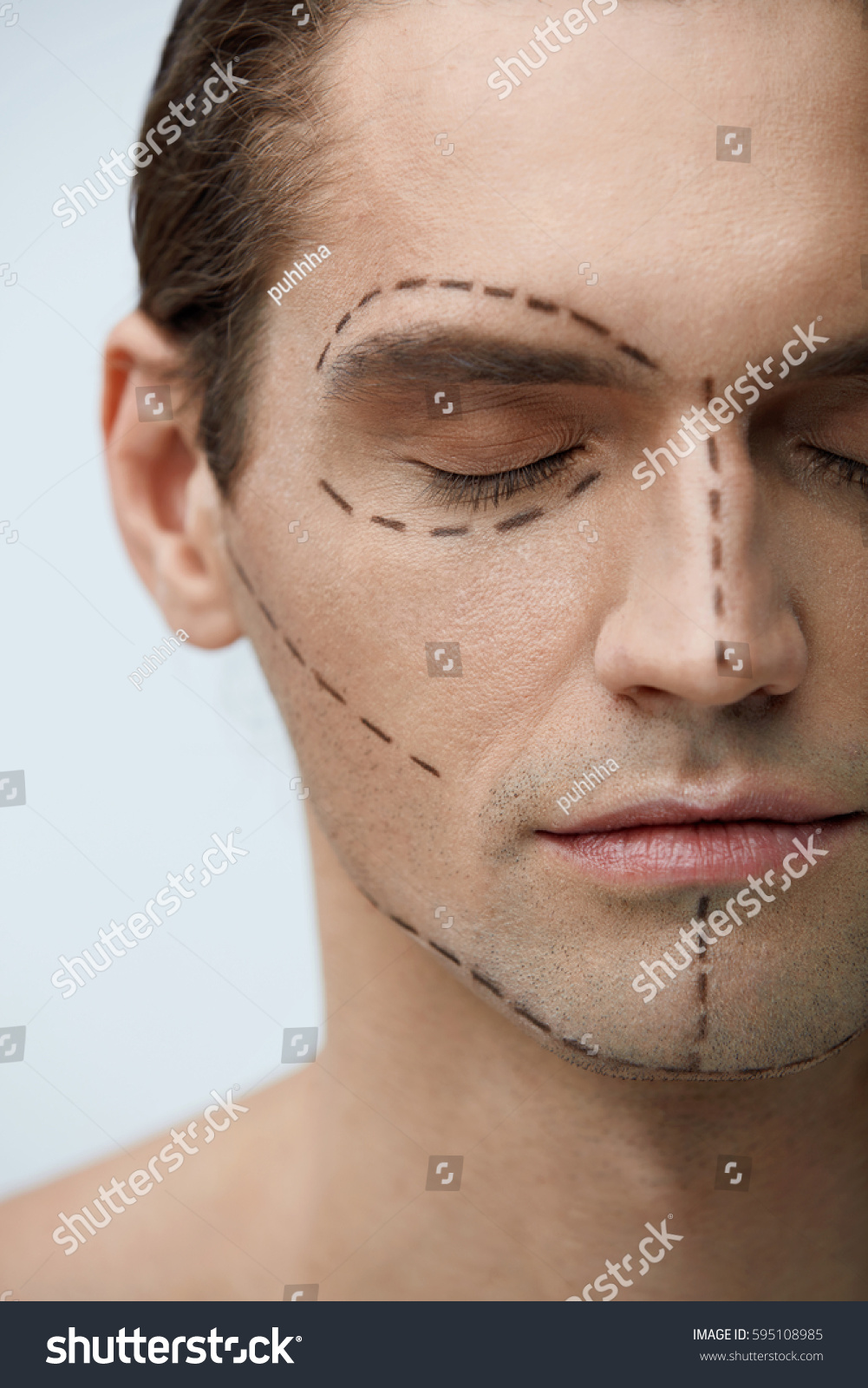 Plastic Surgery Portrait Handsome Young Man Stock Photo Edit Now