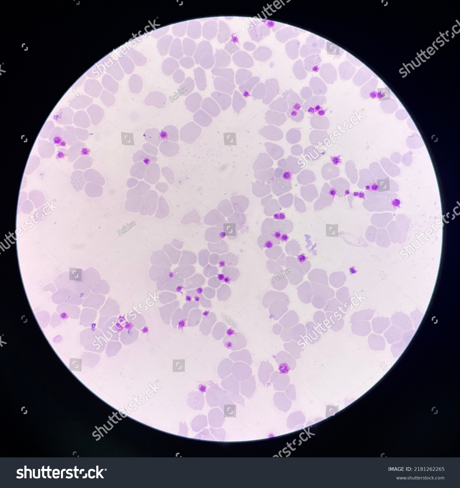 Platelet Smear Increase Clumping Stock Photo 2181262265 | Shutterstock