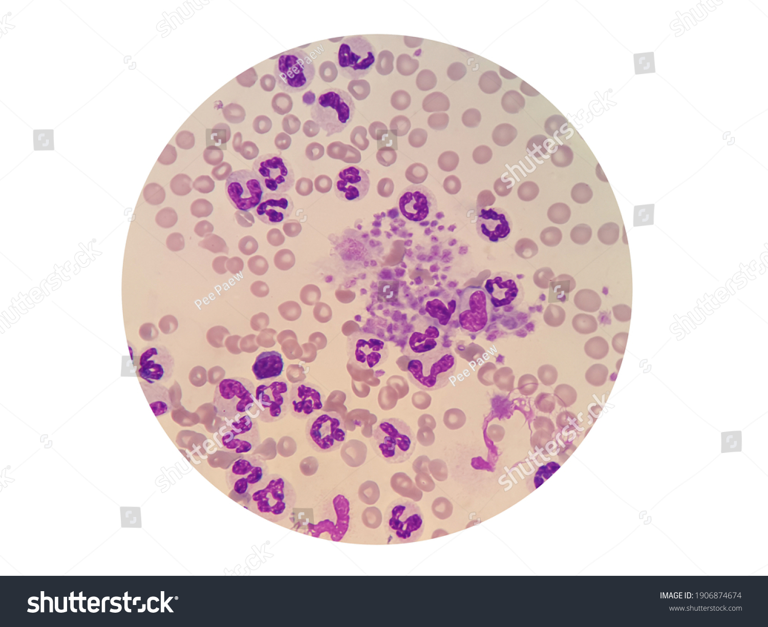 165 Platelet clumping 이미지 스톡 사진 및 벡터 Shutterstock