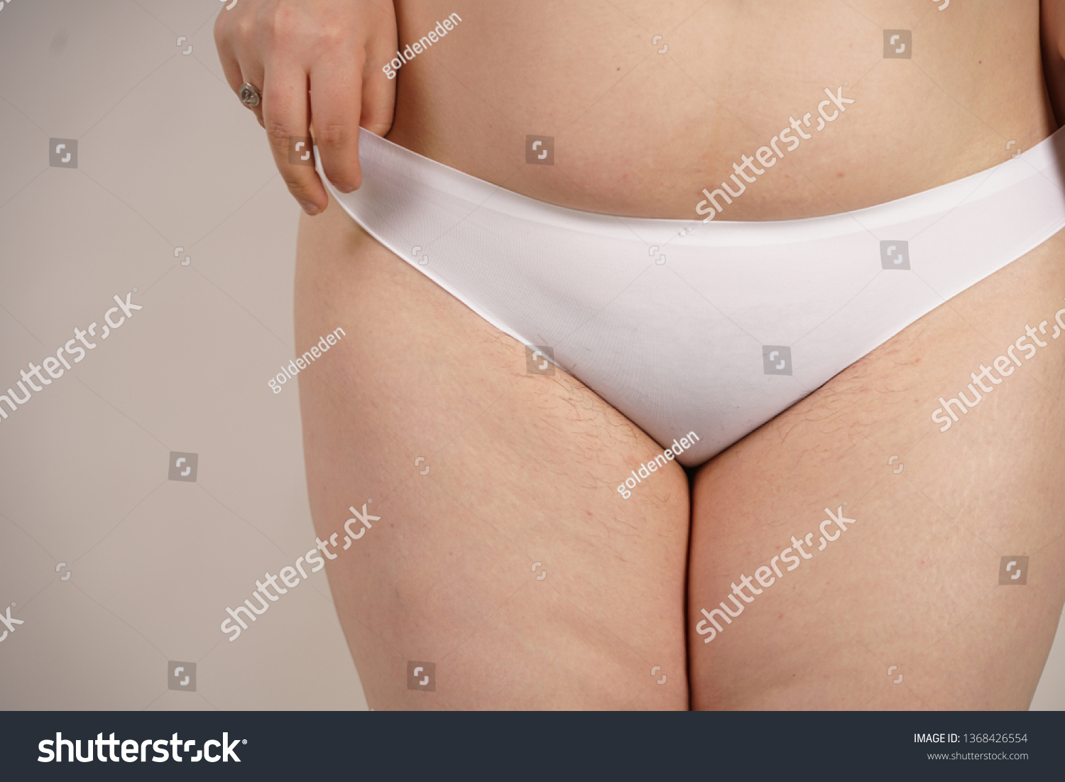 Plus Overweight Woman Stretches Marks Stock Photo Now) 1368426554