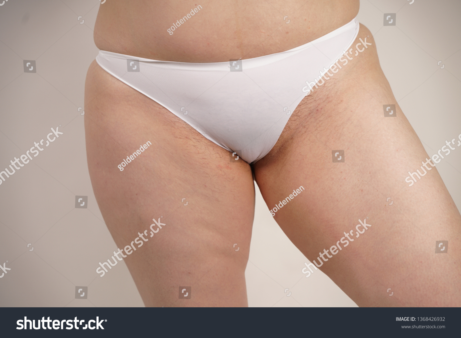 Plus Size Overweight Woman Stretches Marks Stock Photo (Edit Now)