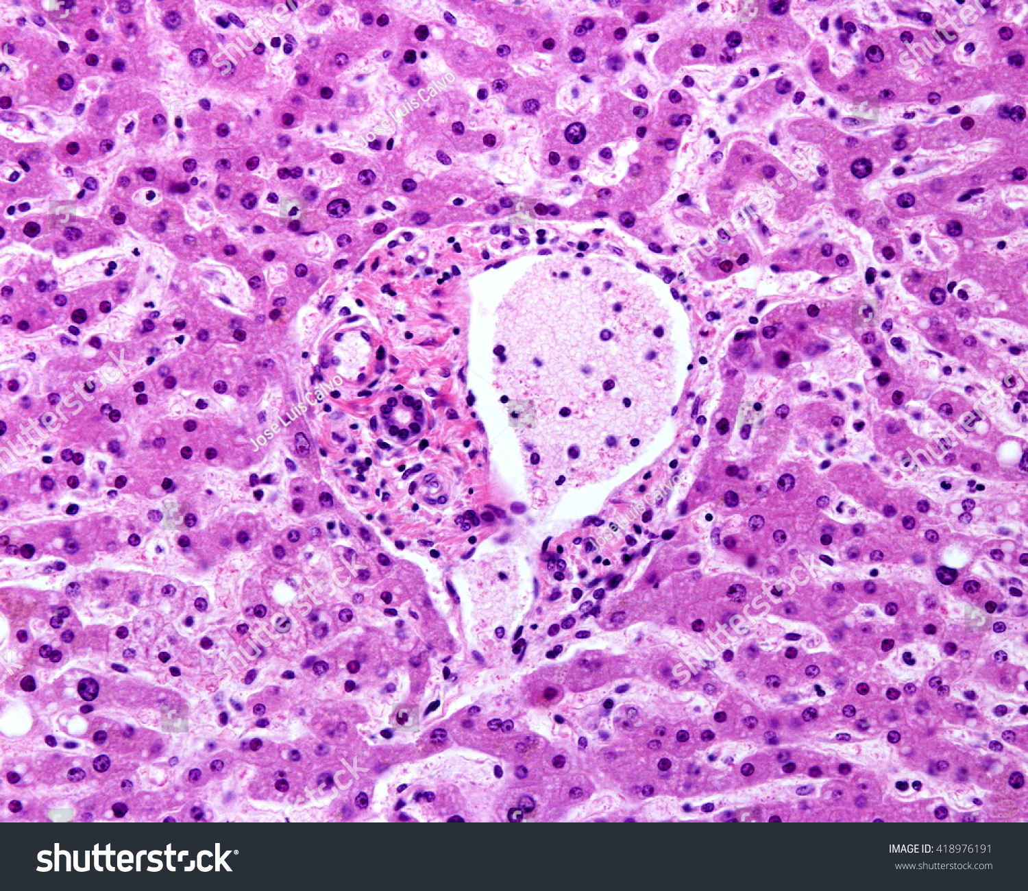 Portal Triad Histology Labeled