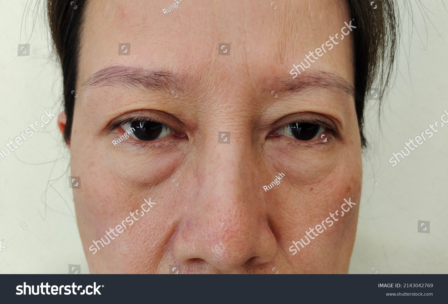 Portrait Showing Flabbiness Adipose Skin On Stock Photo 2143042769 ...