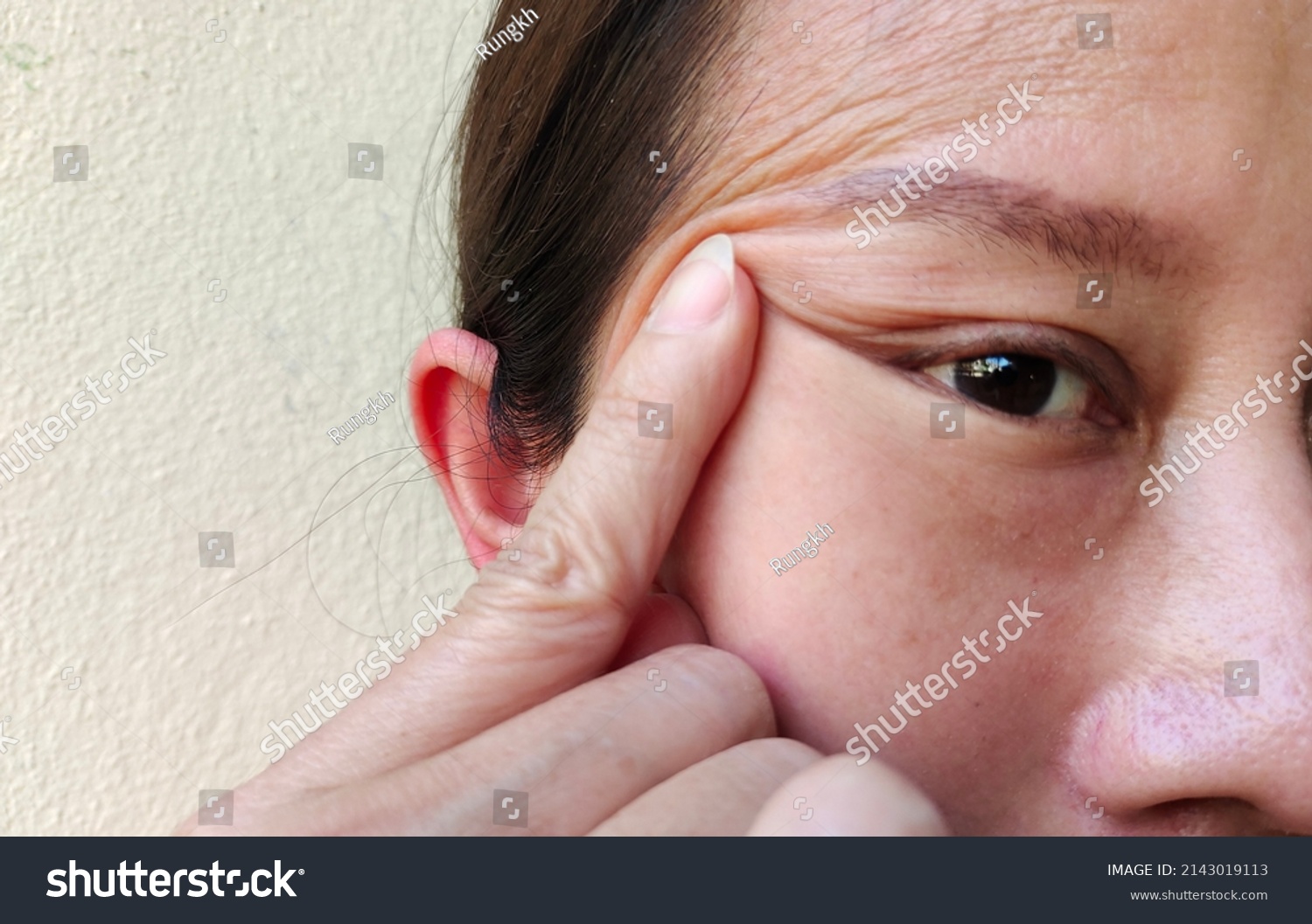 Portrait Fingers Squeezing Adipose Hanging Skin Stock Photo 2143019113