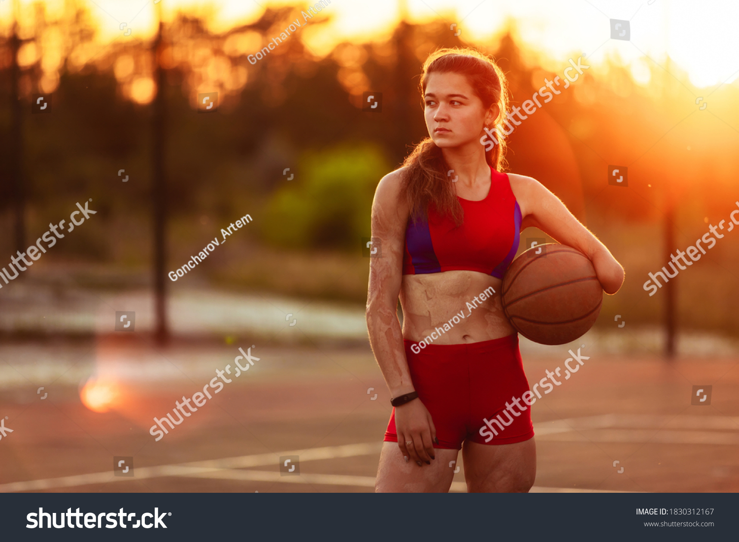 Portrait Young Woman Athlete Amputated Arm Stok Fotoğrafı 1830312167