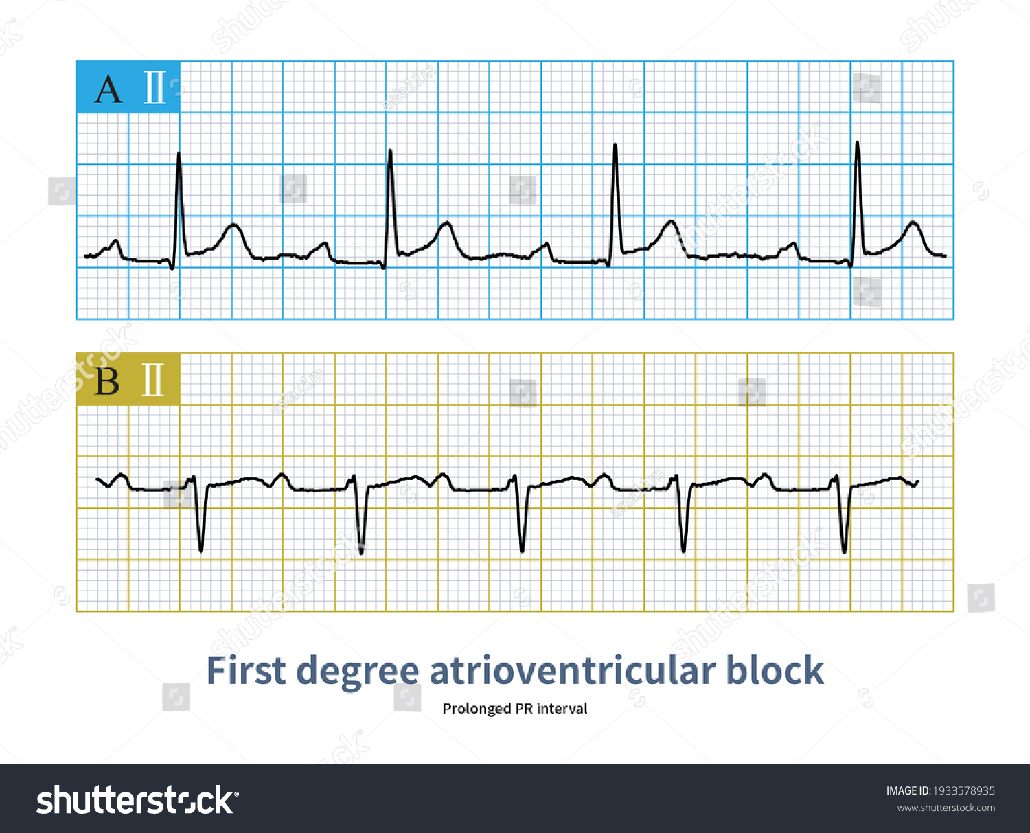 82 Pr interval Images, Stock Photos & Vectors | Shutterstock